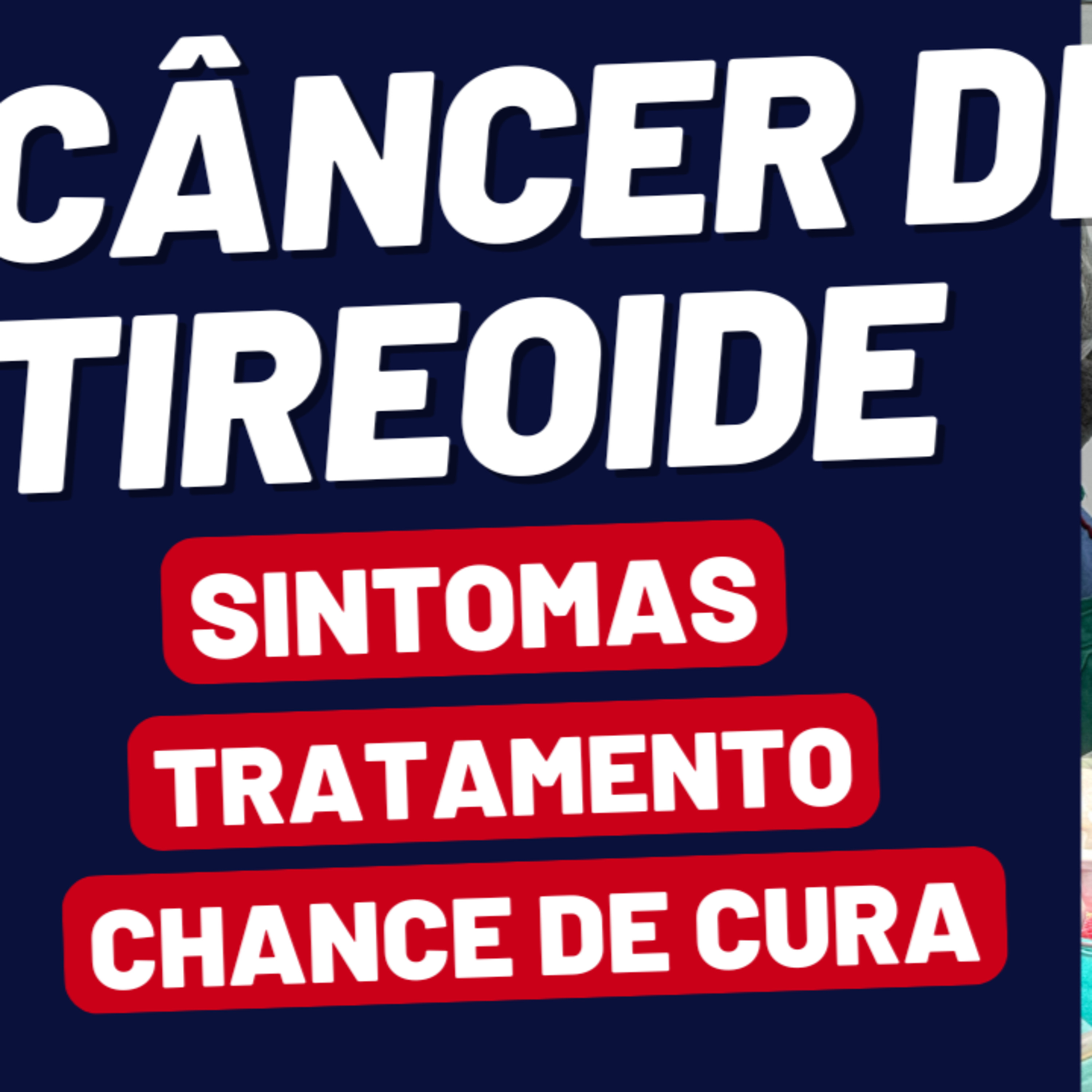 Descomplicando a Tireóide - Dr Jônatas Catunda, cirurgião de cabeça e pescoço