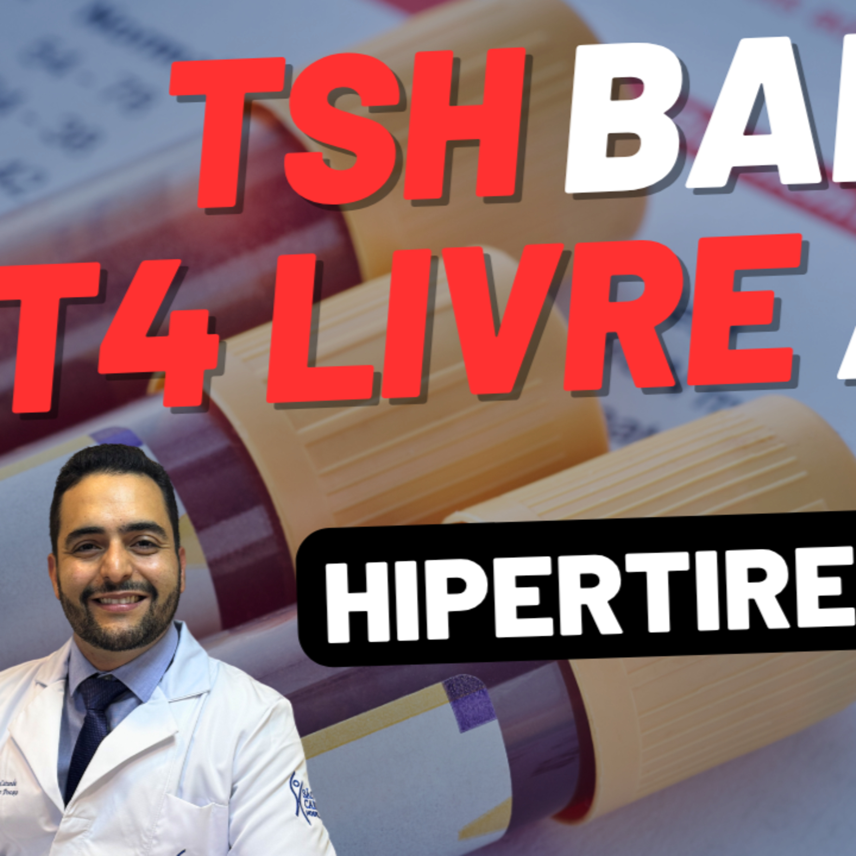 TSH BAIXO, T4 LIVRE ALTO - HIPERTIREOIDISMO POR DOENÇA DE GRAVES ...