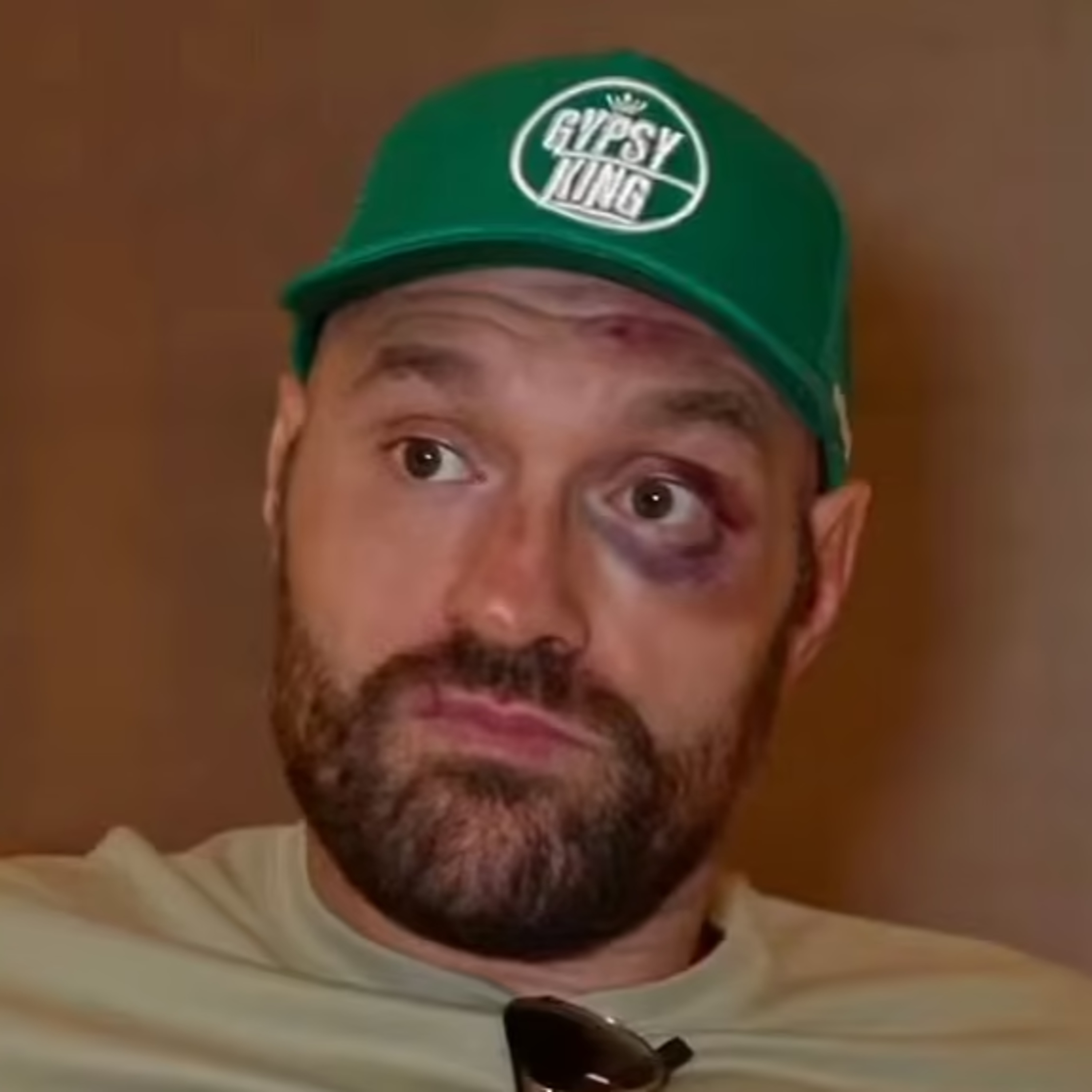 ¿Tyson Fury Hizo Quedar Mal Al Boxeo? Zoom Sports Miércoles 01/11/23 episode artwork
