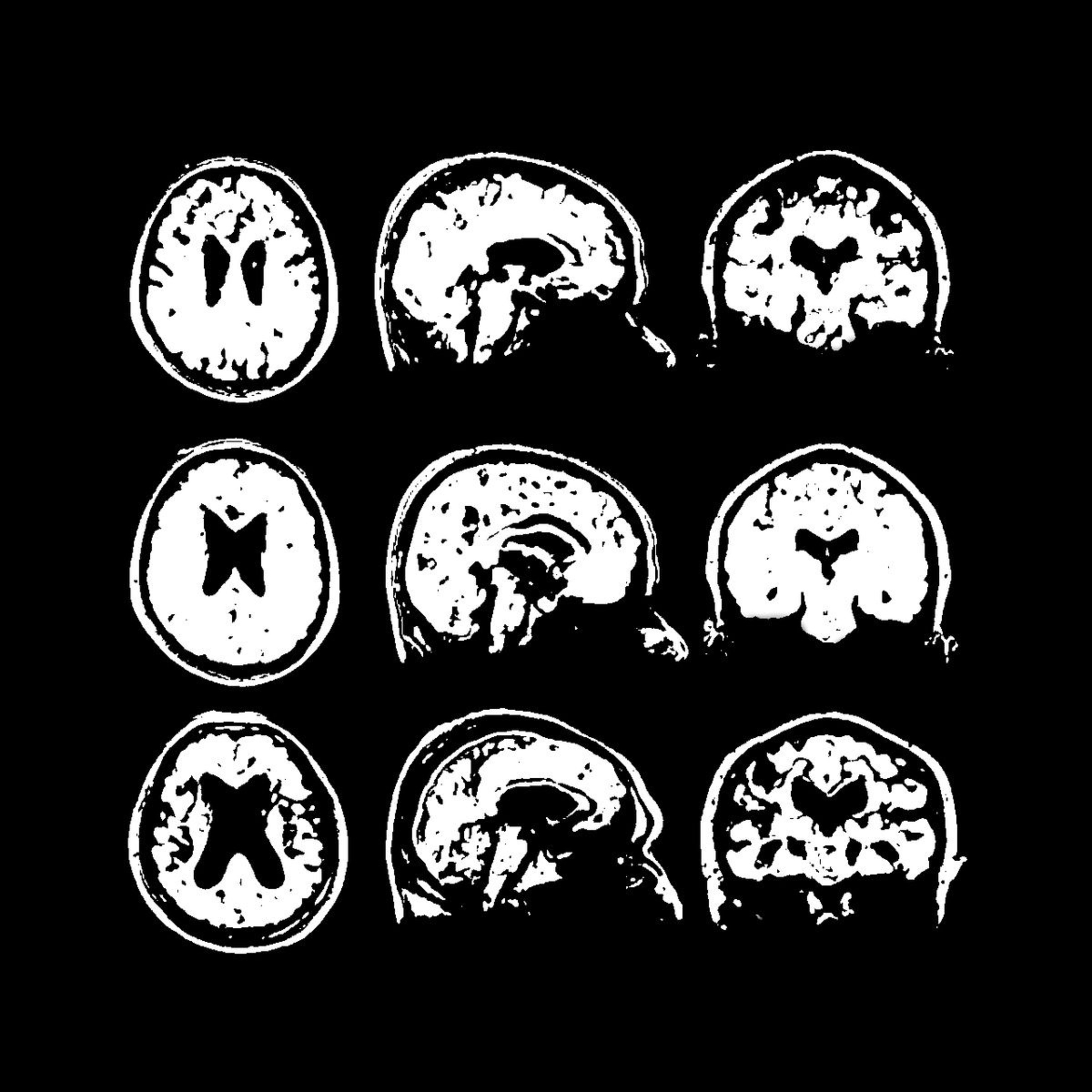 CEREBROGRAGHY (Yap Session) episode artwork