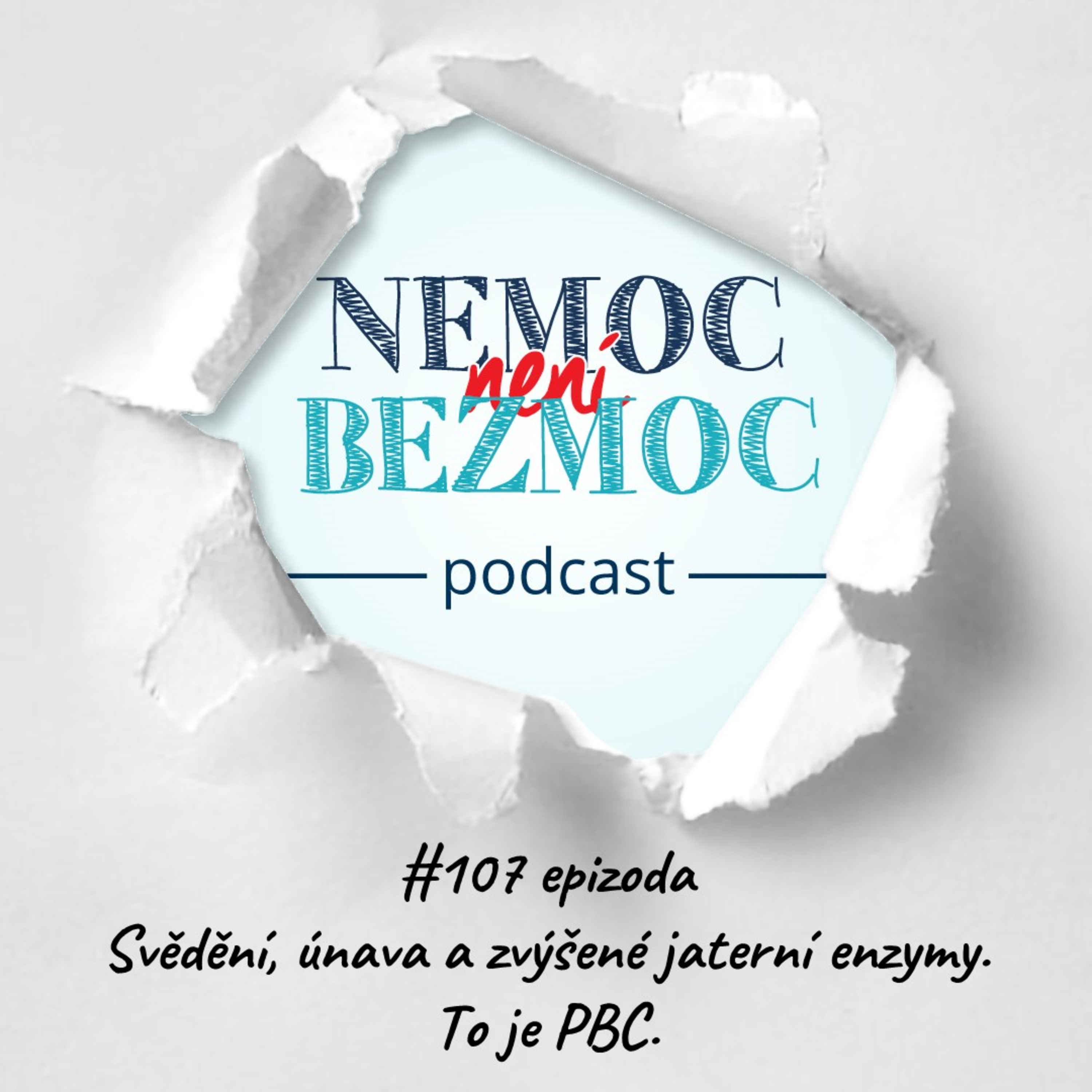 Svědění, únava a zvýšené jaterní enzymy. To je PBC. episode artwork