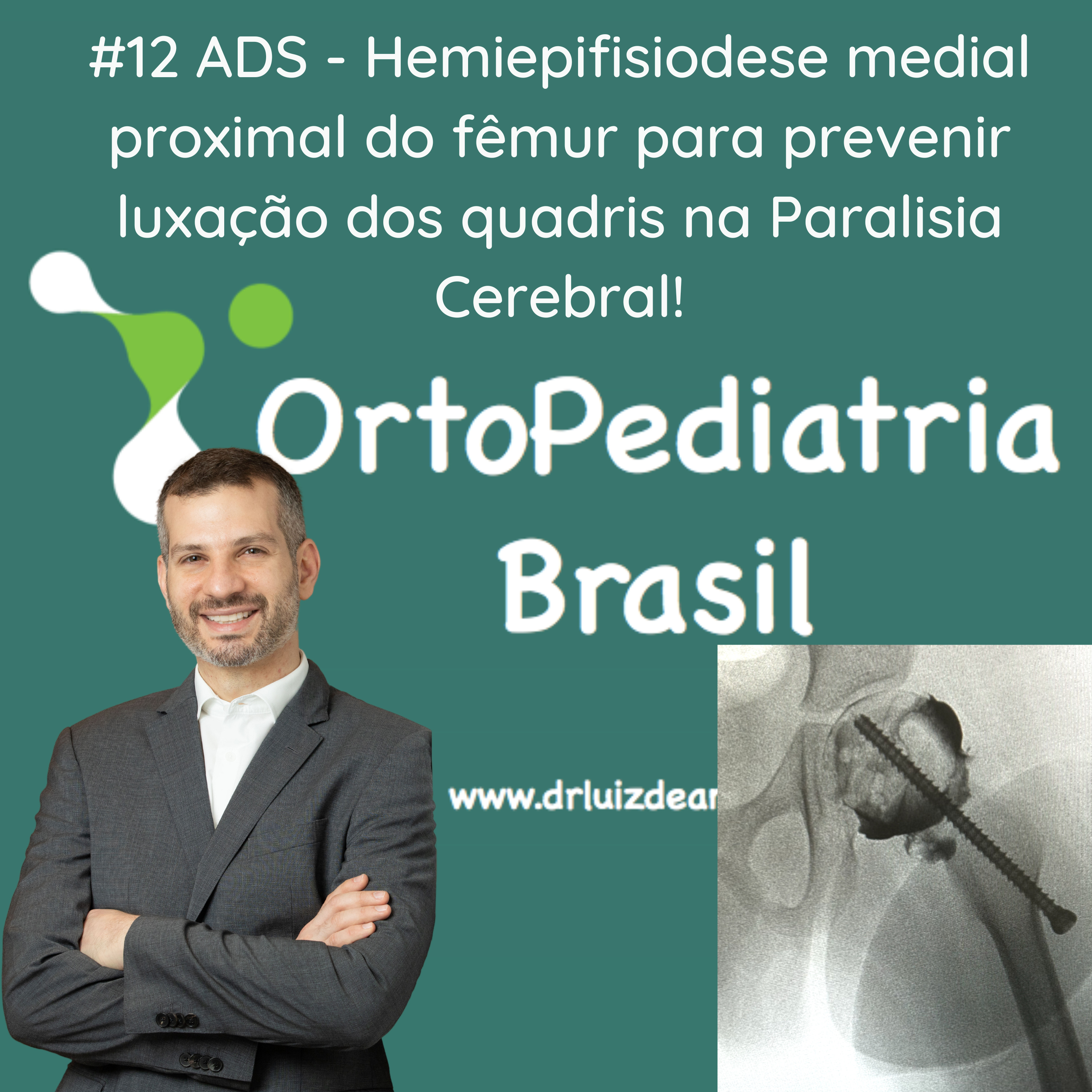 OrtoPediatria Brasil