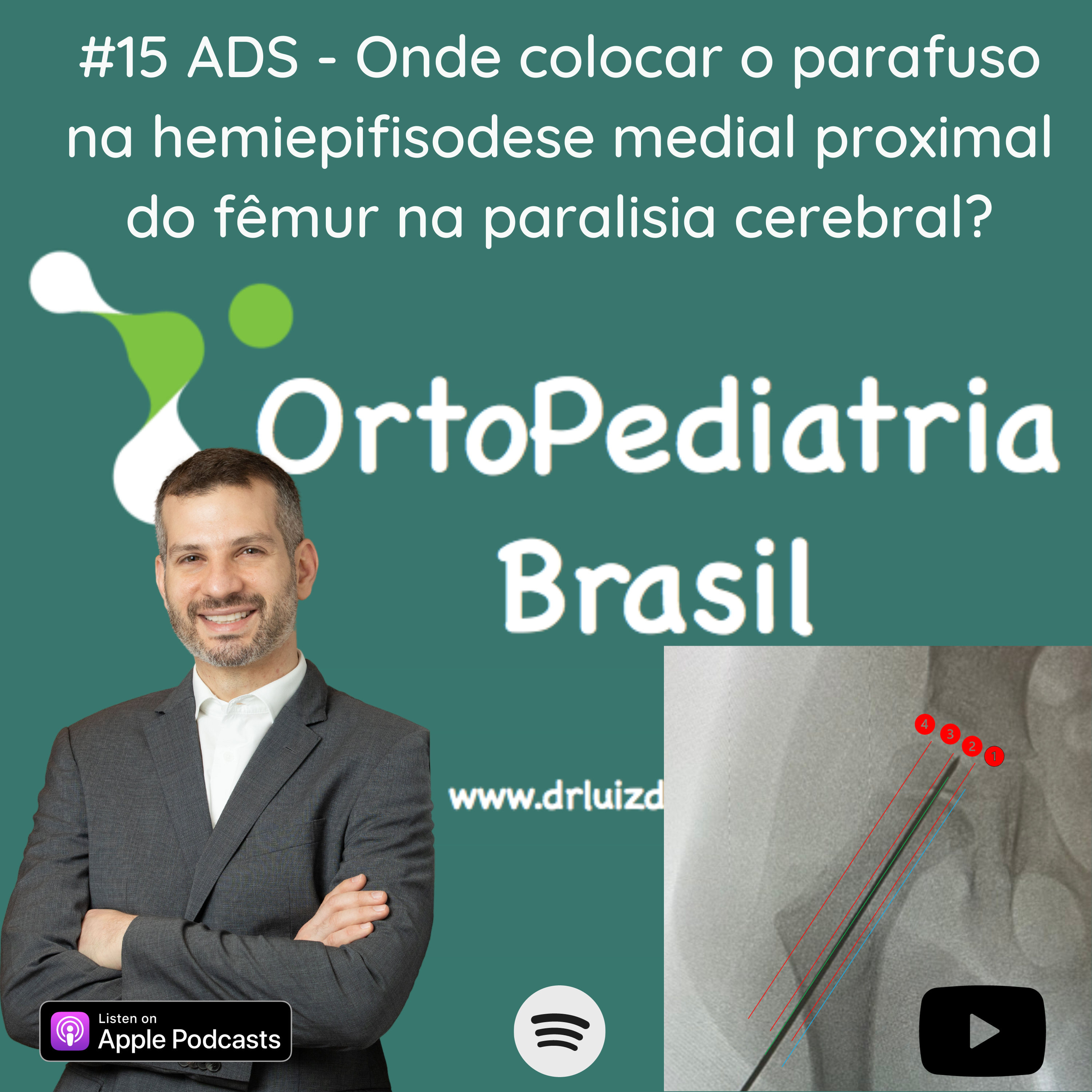 OrtoPediatria Brasil