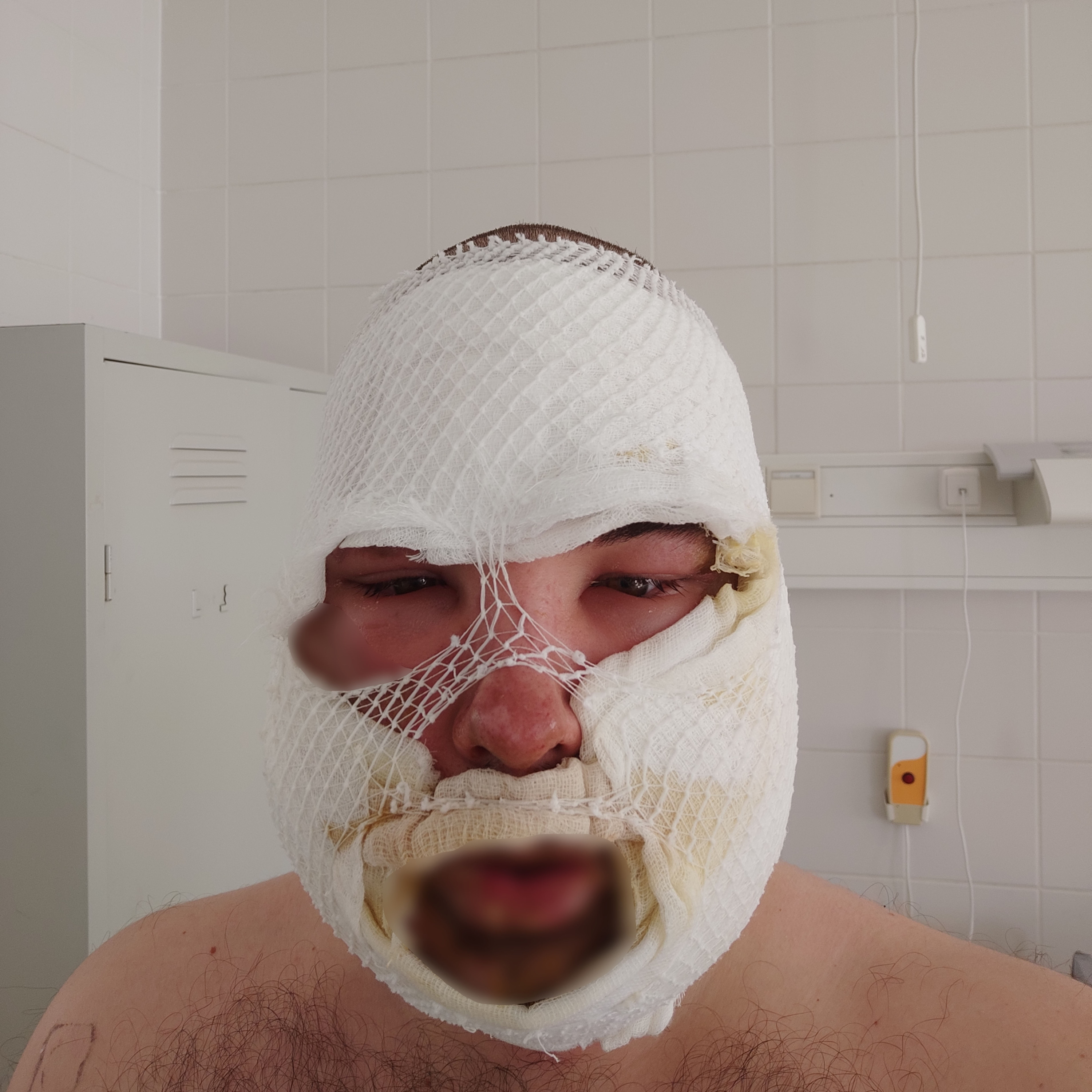 Sav marta szét az arcát a szolnoki gyárban, tönkrement a fiatalember élete episode artwork