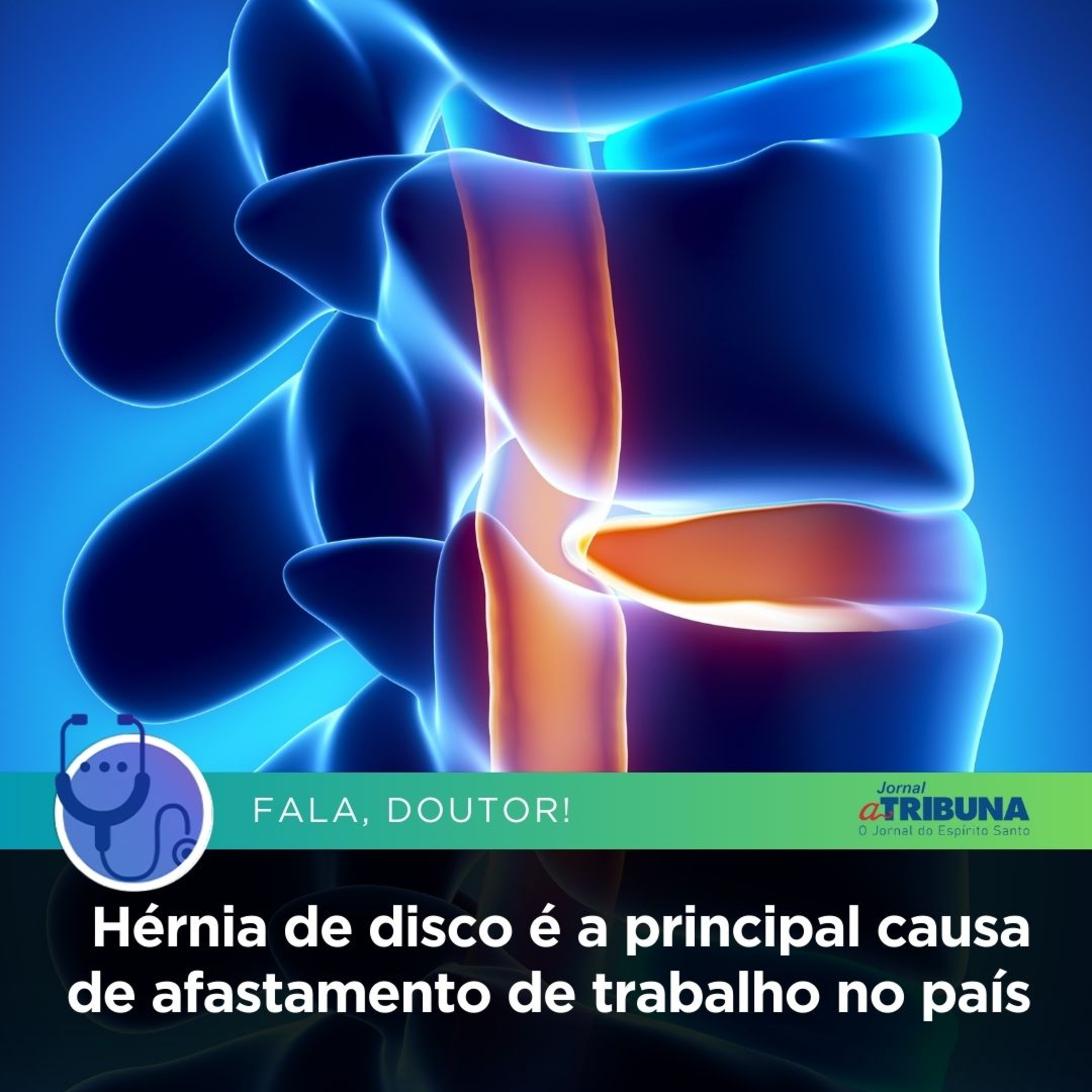 Hérnia de disco é a principal causa de afastamento de trabalho no país | Fala, Doutor! episode artwork