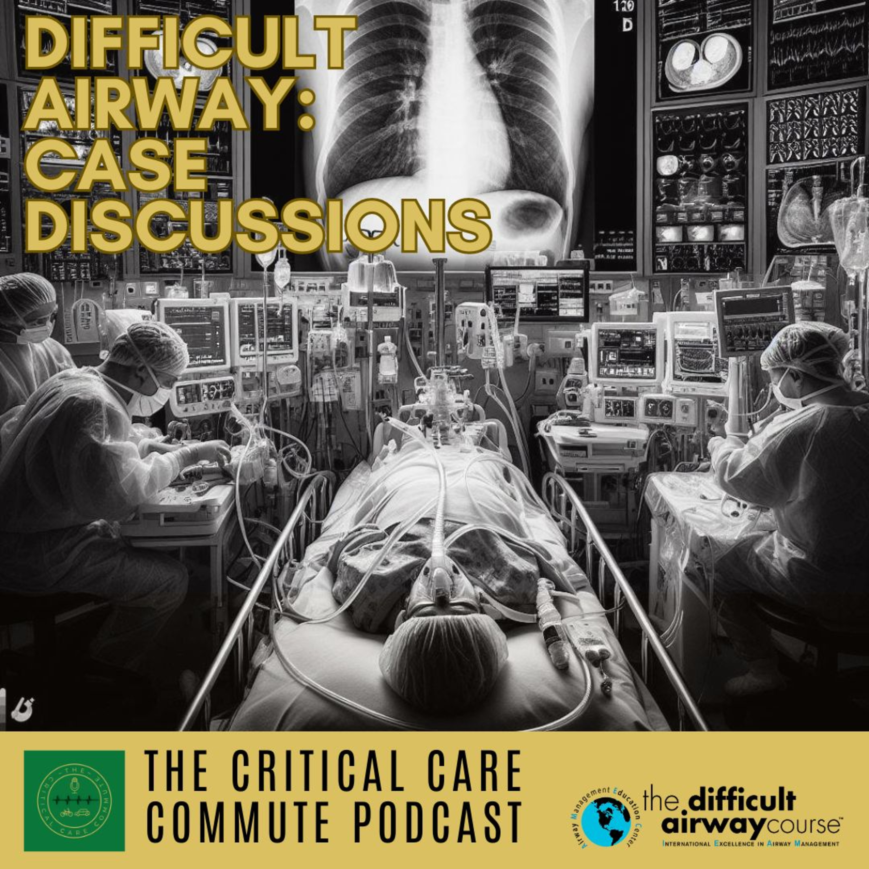 Difficult Airway Cases: Letting the panel take us through scenarios.