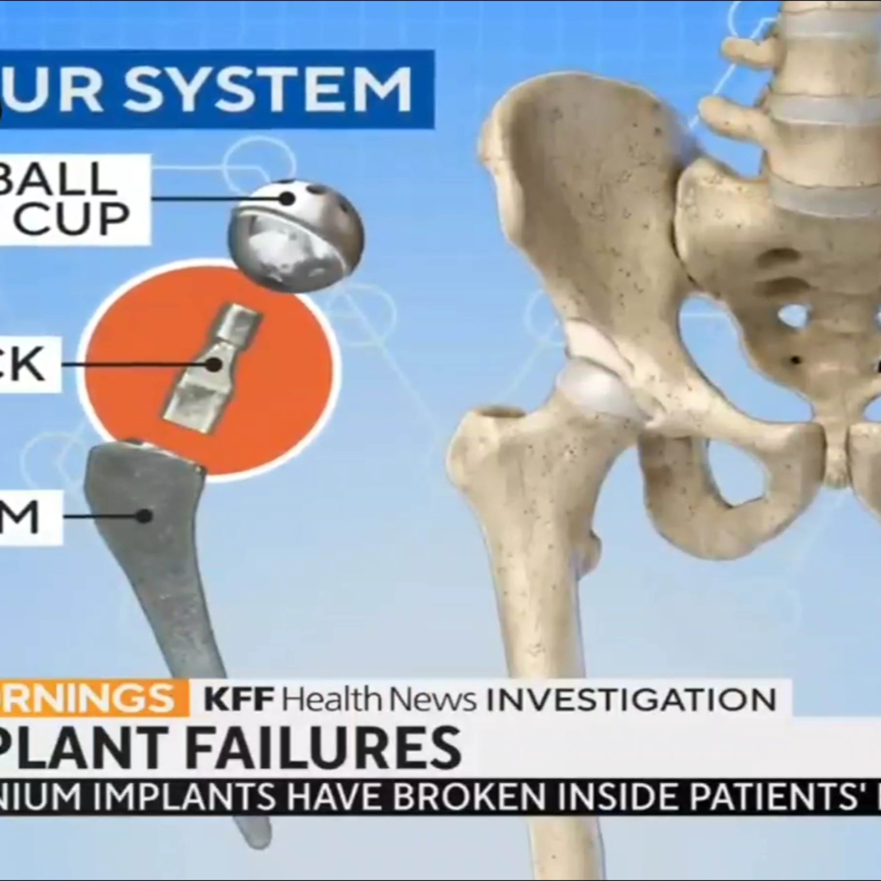 THE UGLY TRUTH ABOUT MEDICAL SURGERIES