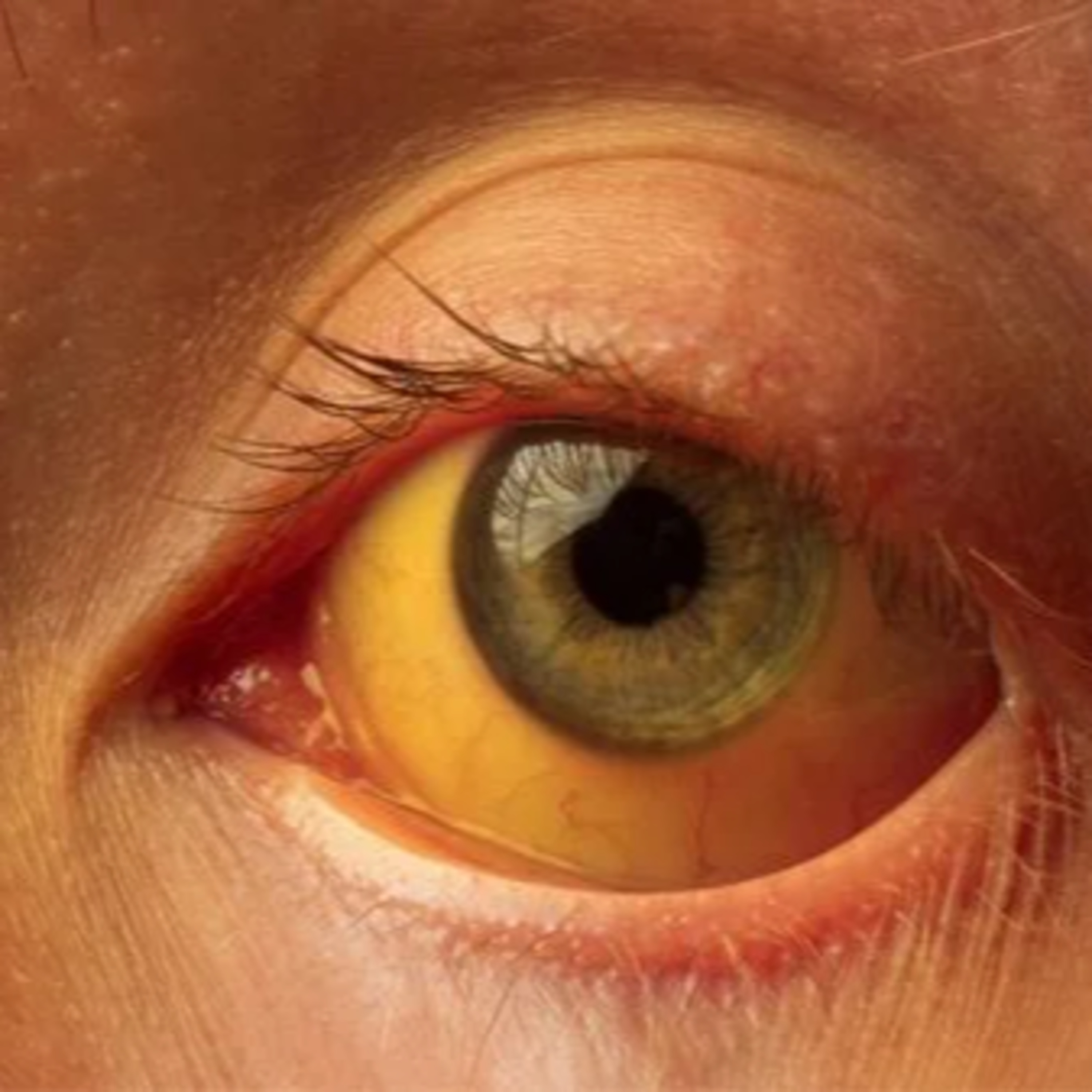 CBN Vitória - Entrevistas