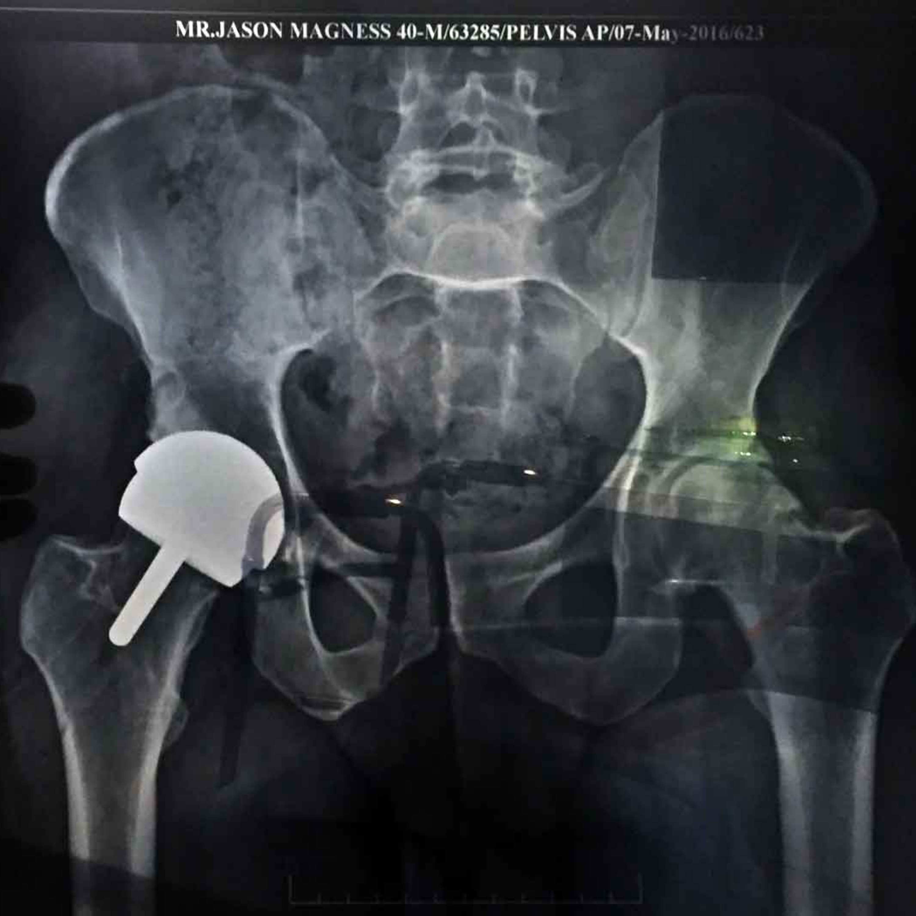 The Bend Racing Podcast