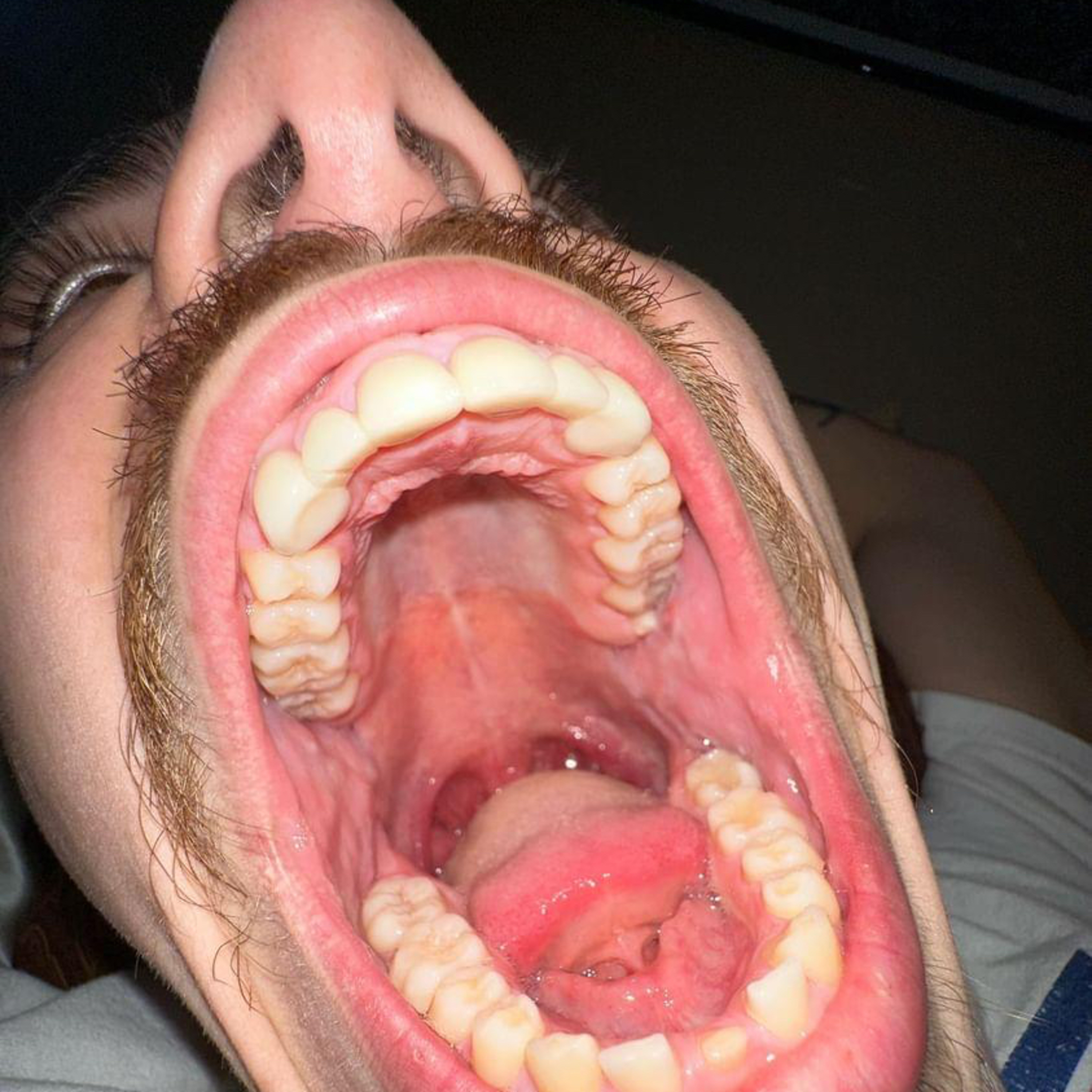 maS
