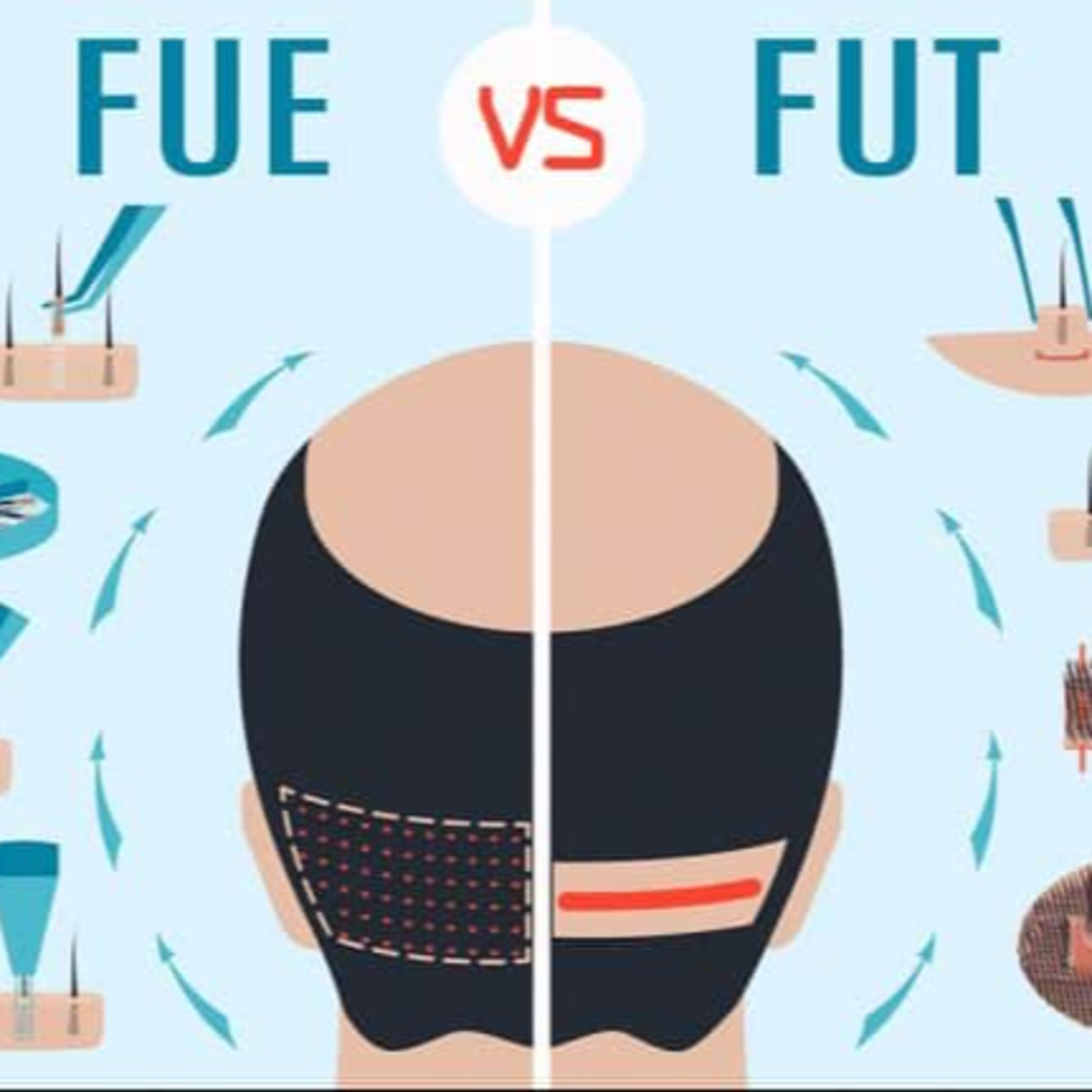 Hair Loss 101