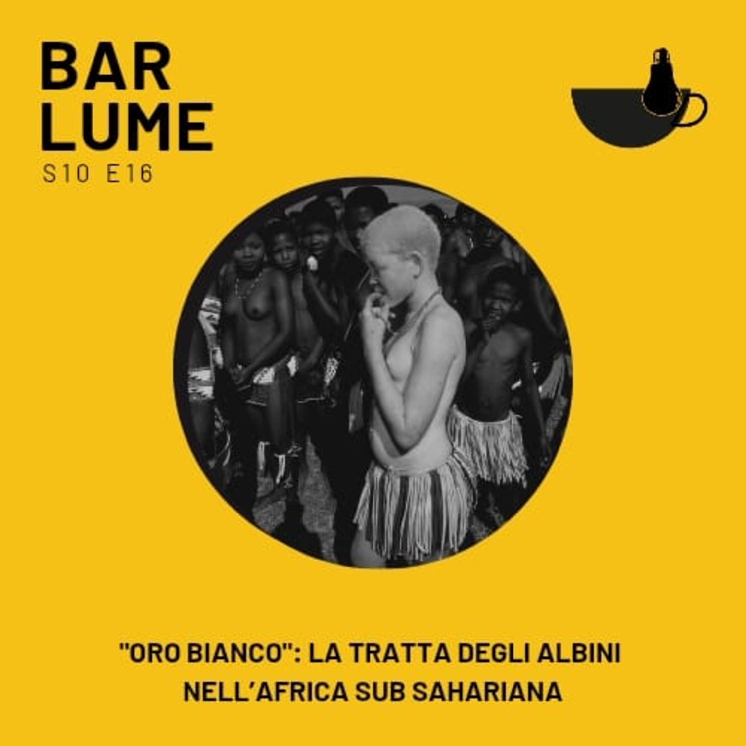 Ep. 175: "Oro bianco". La tratta degli albini nell’Africa Sub Sahariana episode artwork