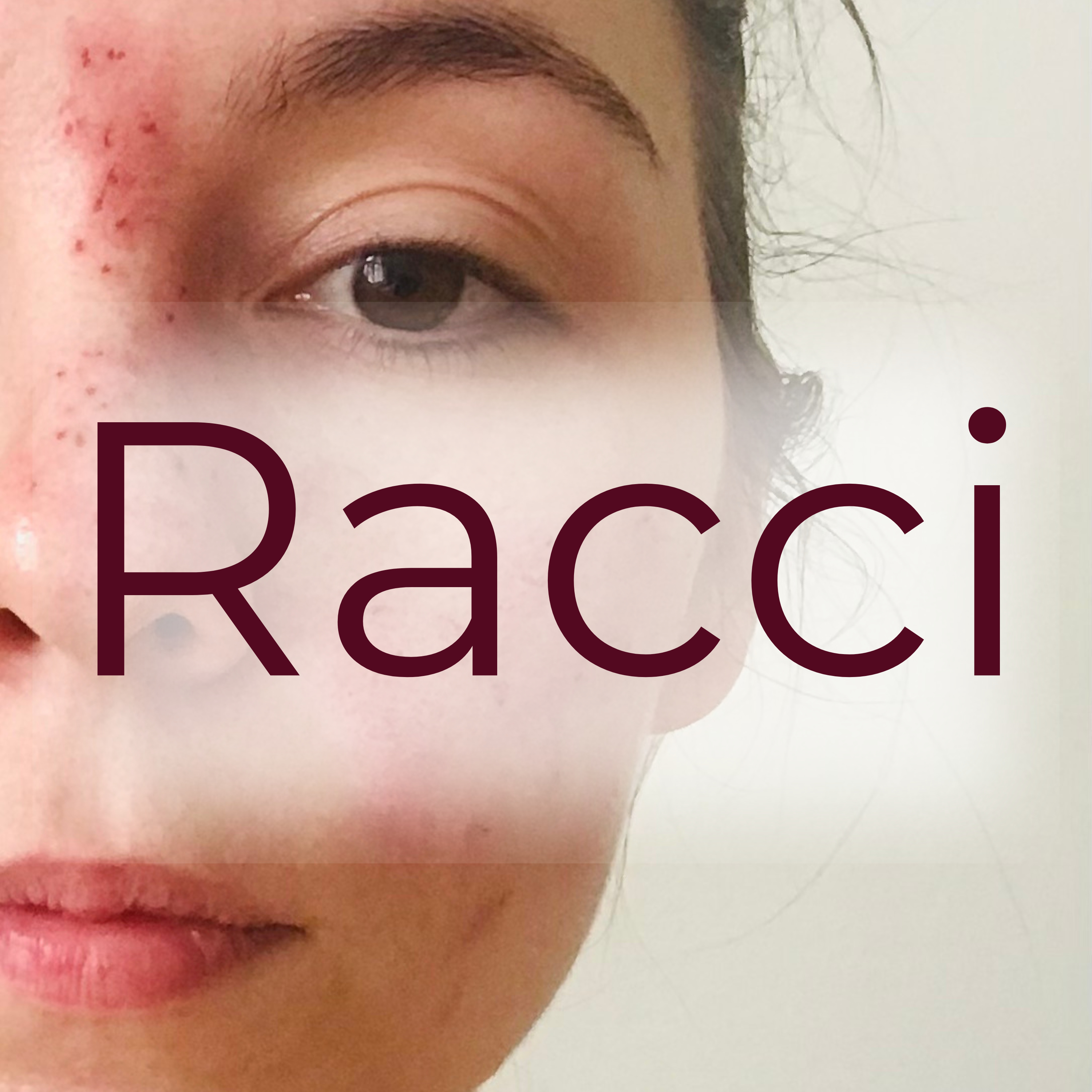 Racci