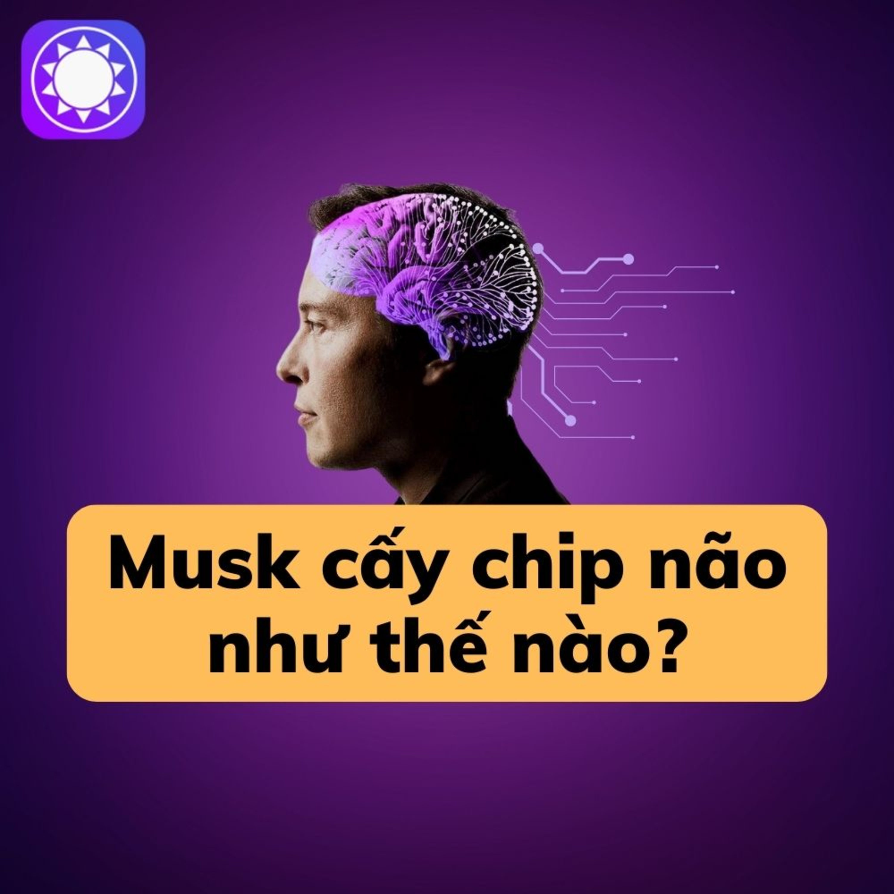 Elon Musk cấy chip vào não người như thế nào? episode artwork