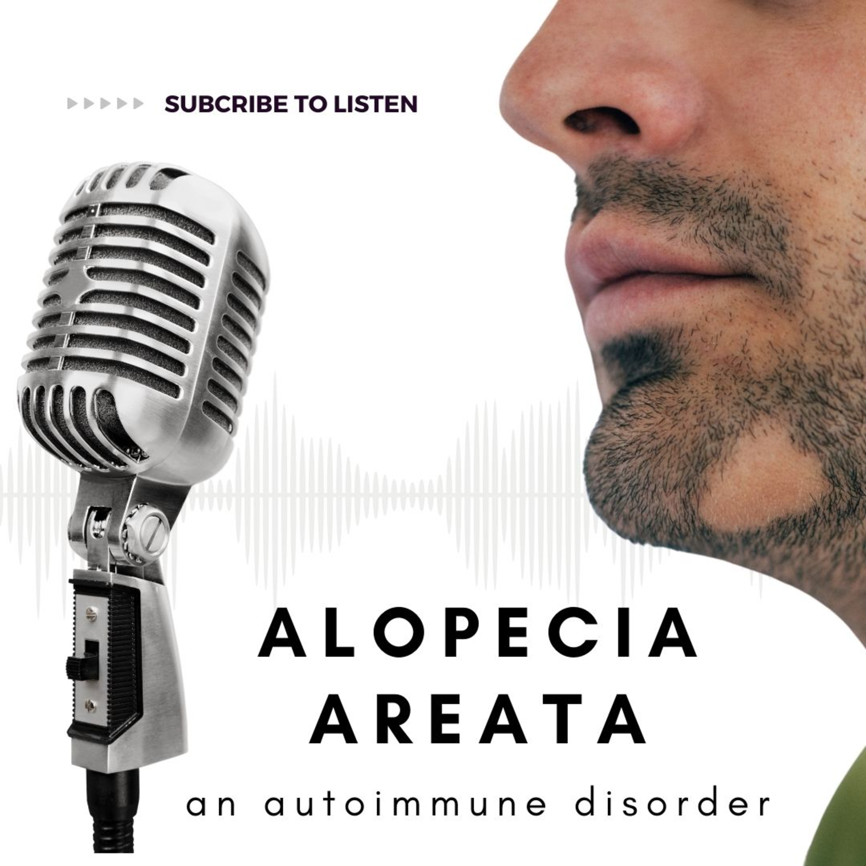 Alopecia Areata episode artwork