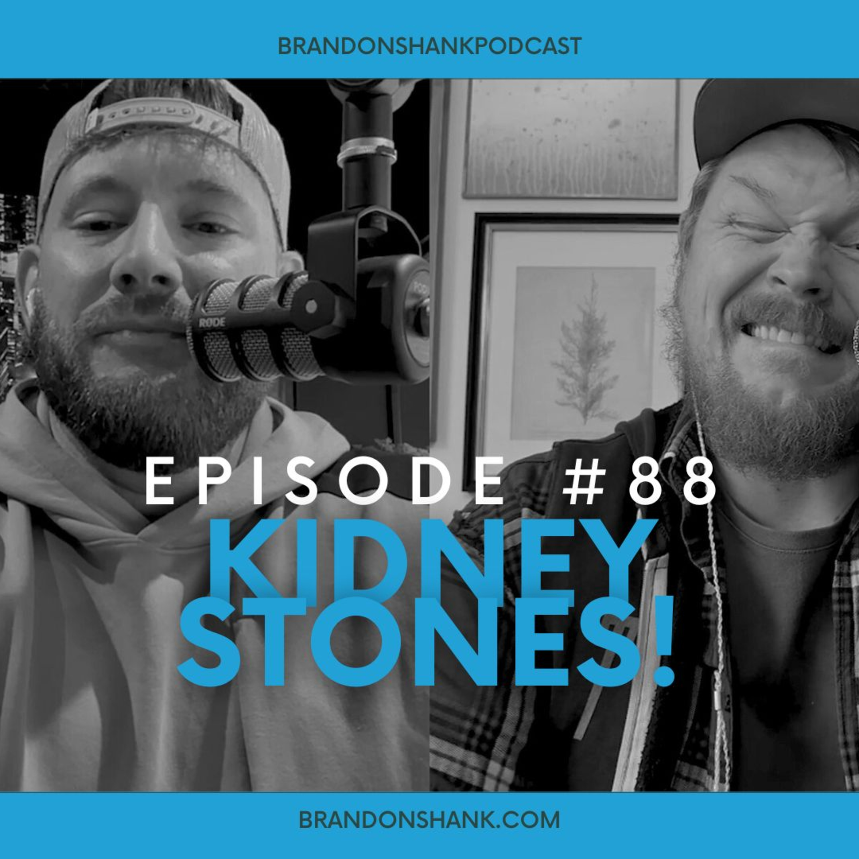 Episode #88 | Kidney Stones episode artwork
