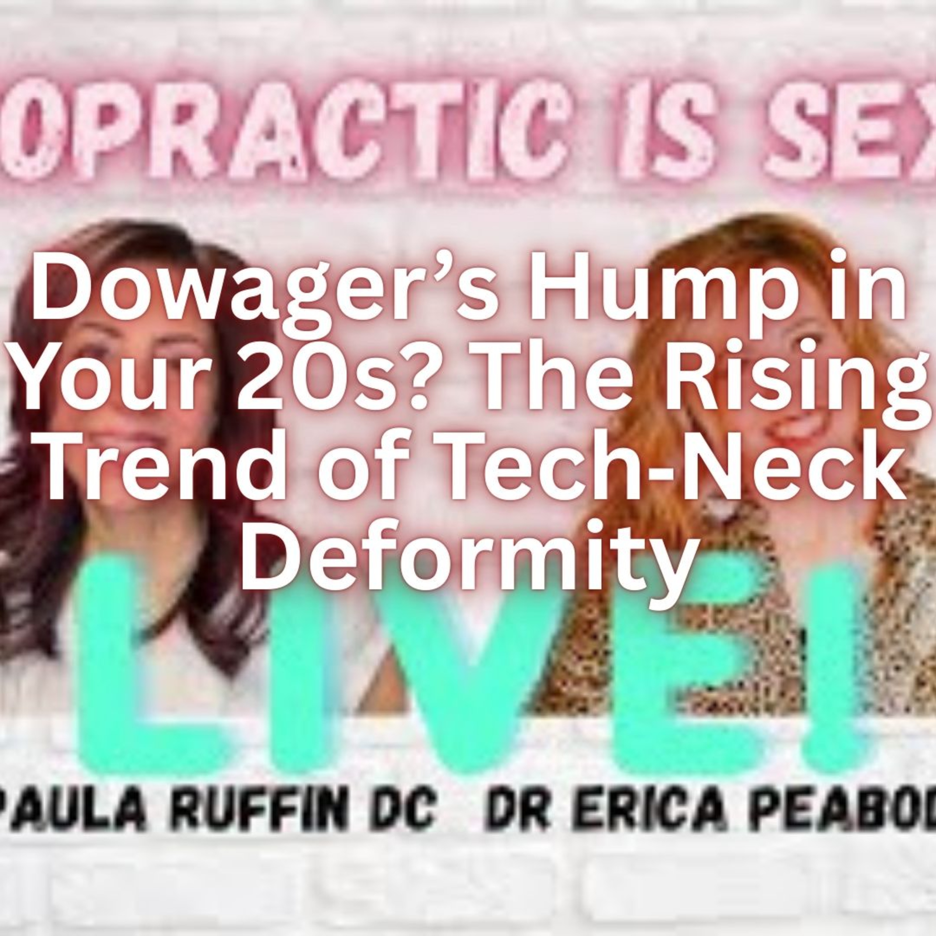 Dowager’s Hump in Your 20s? The Rising Trend of Tech‑Neck Deformity