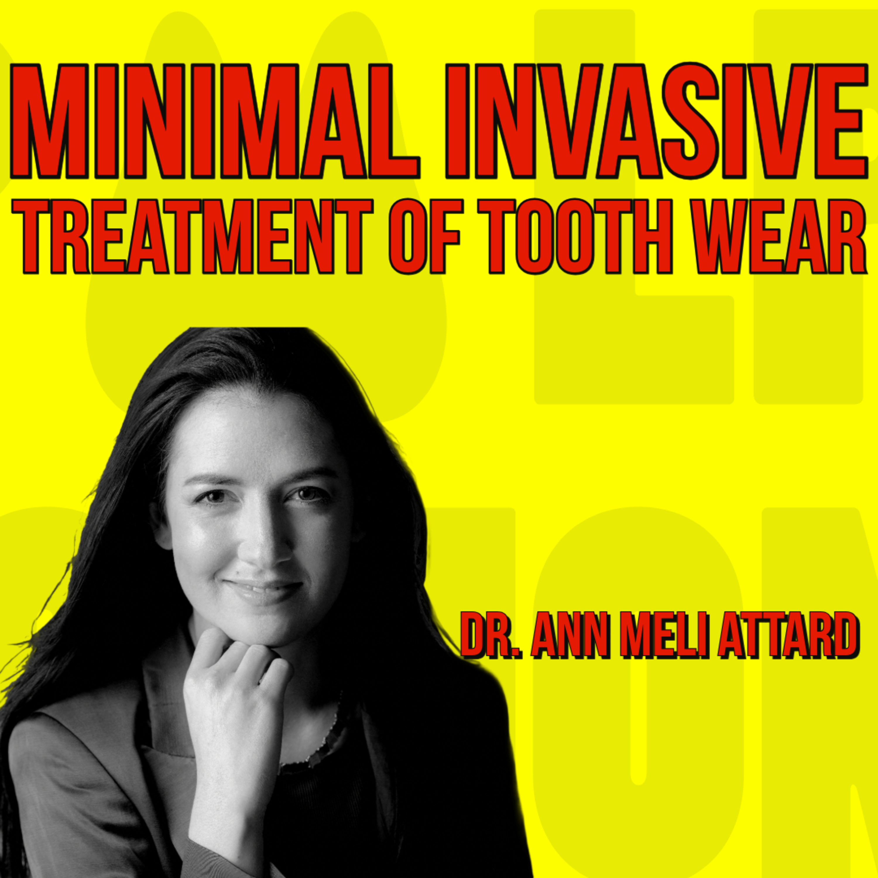 026 Minimal Invasive Treatment of tooth wear with Dr Ann Meli Attard quick IDS talks episode artwork