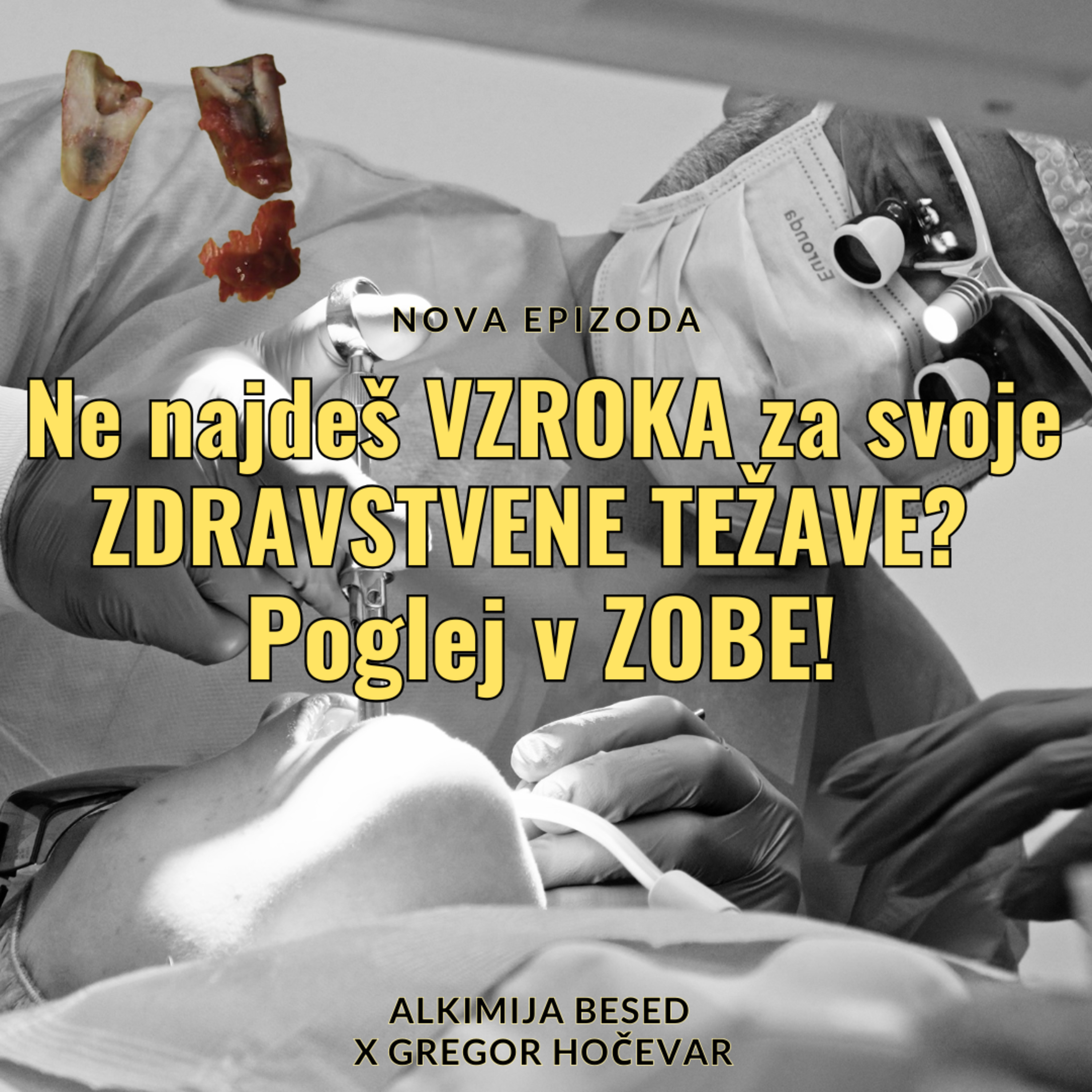 ALKIMIJA BESED - Kaj pa, če so tvoje ZDRAVSTVENE TEŽAVE povezane z ZOBMI? / Dr. GREGOR HOČEVAR o biološkem zobozdravstvu