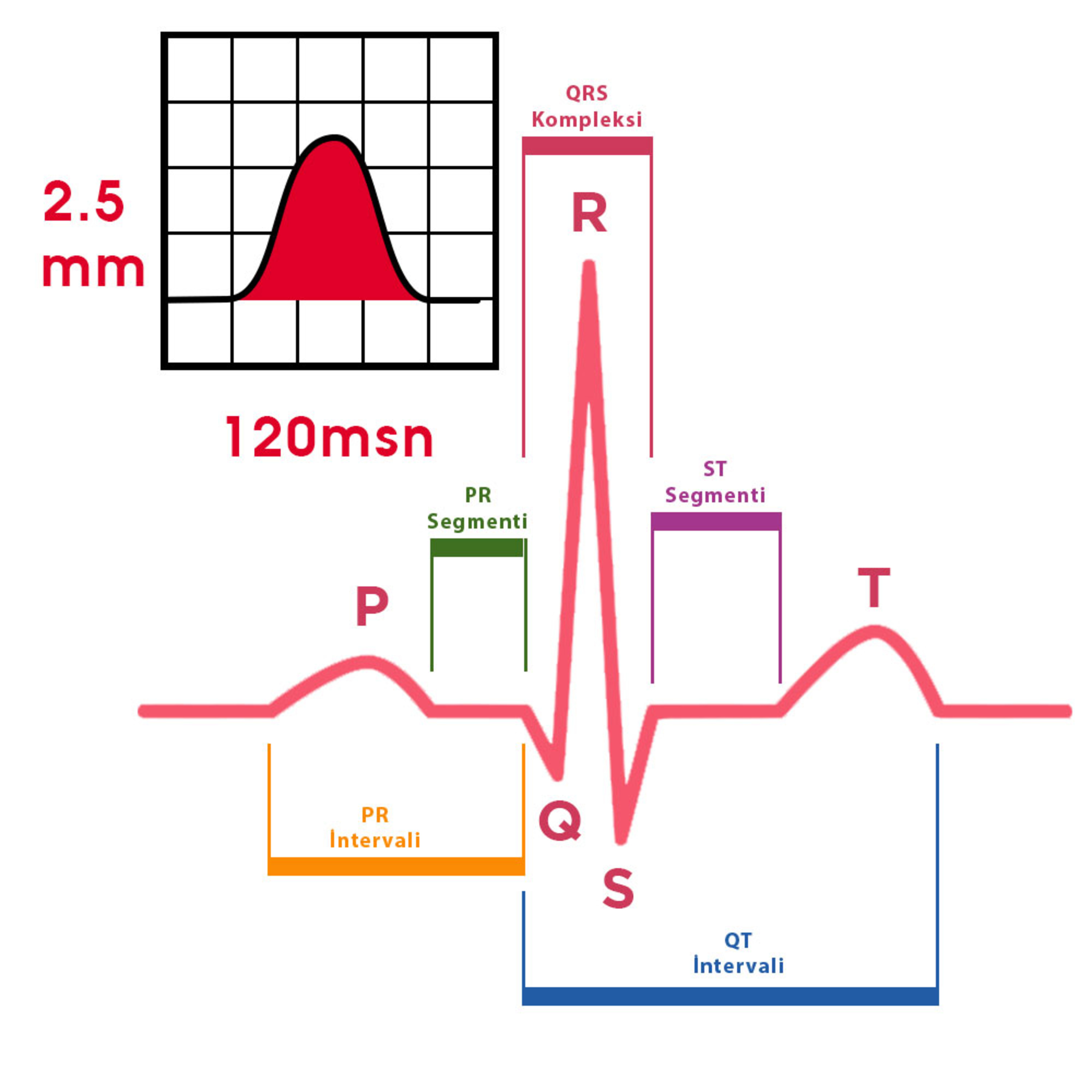 EKG: P Dalgası ve Anormallikleri