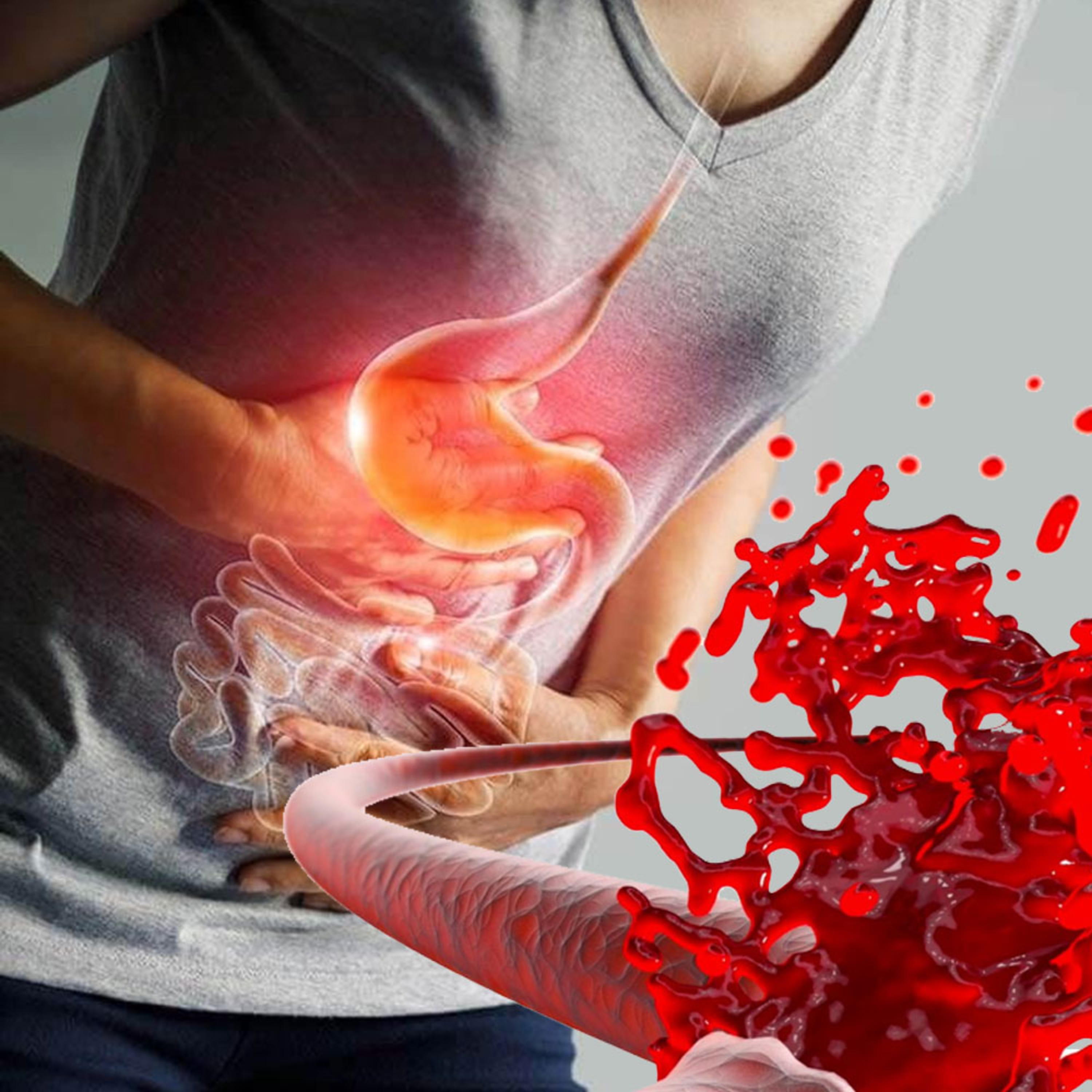 Gastrointestinal Sistem Kanamalarına Genel Bakış