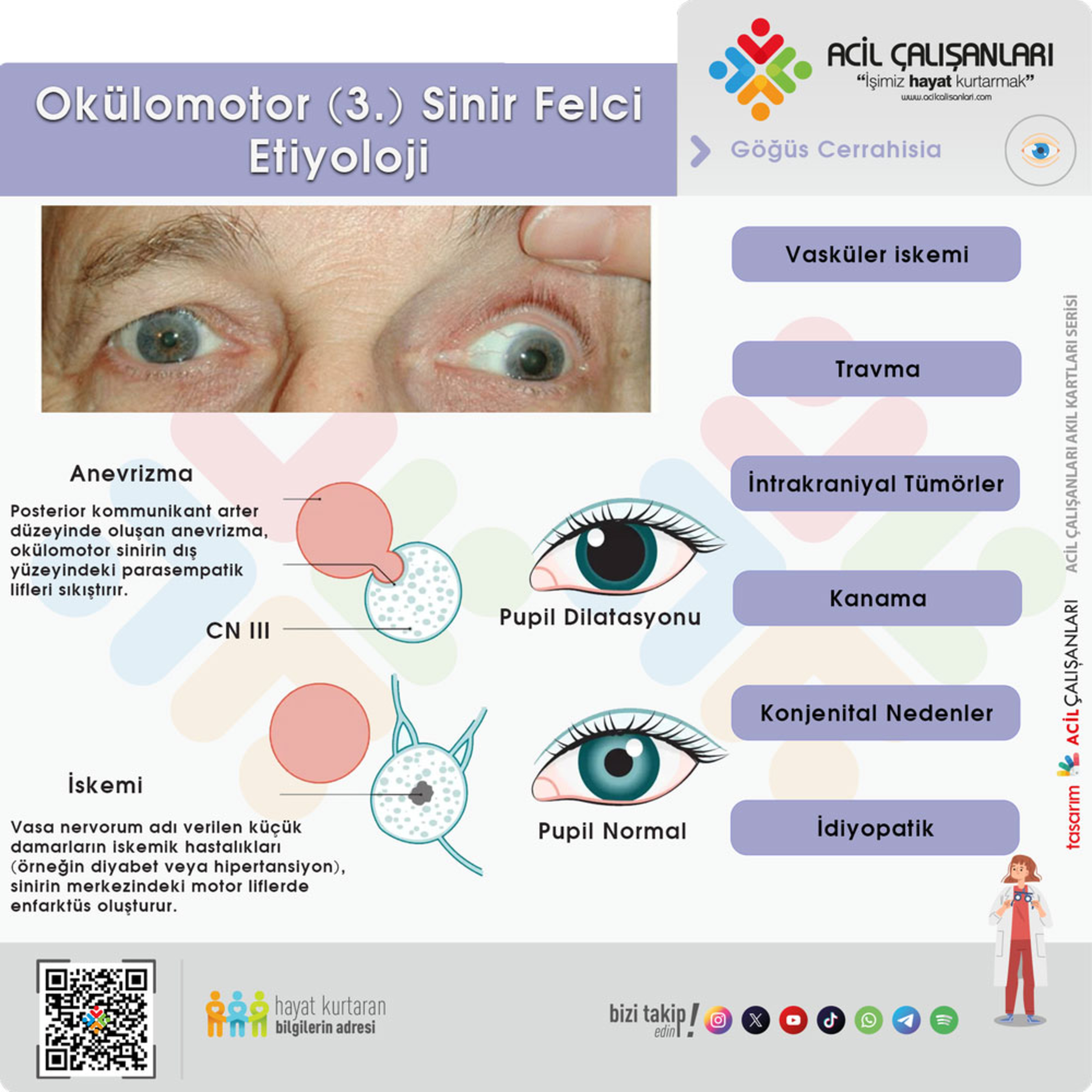 Okülomotor (3. Kranial) Sinir Felci – Acil Serviste Tanı ve Yaklaşım episode artwork