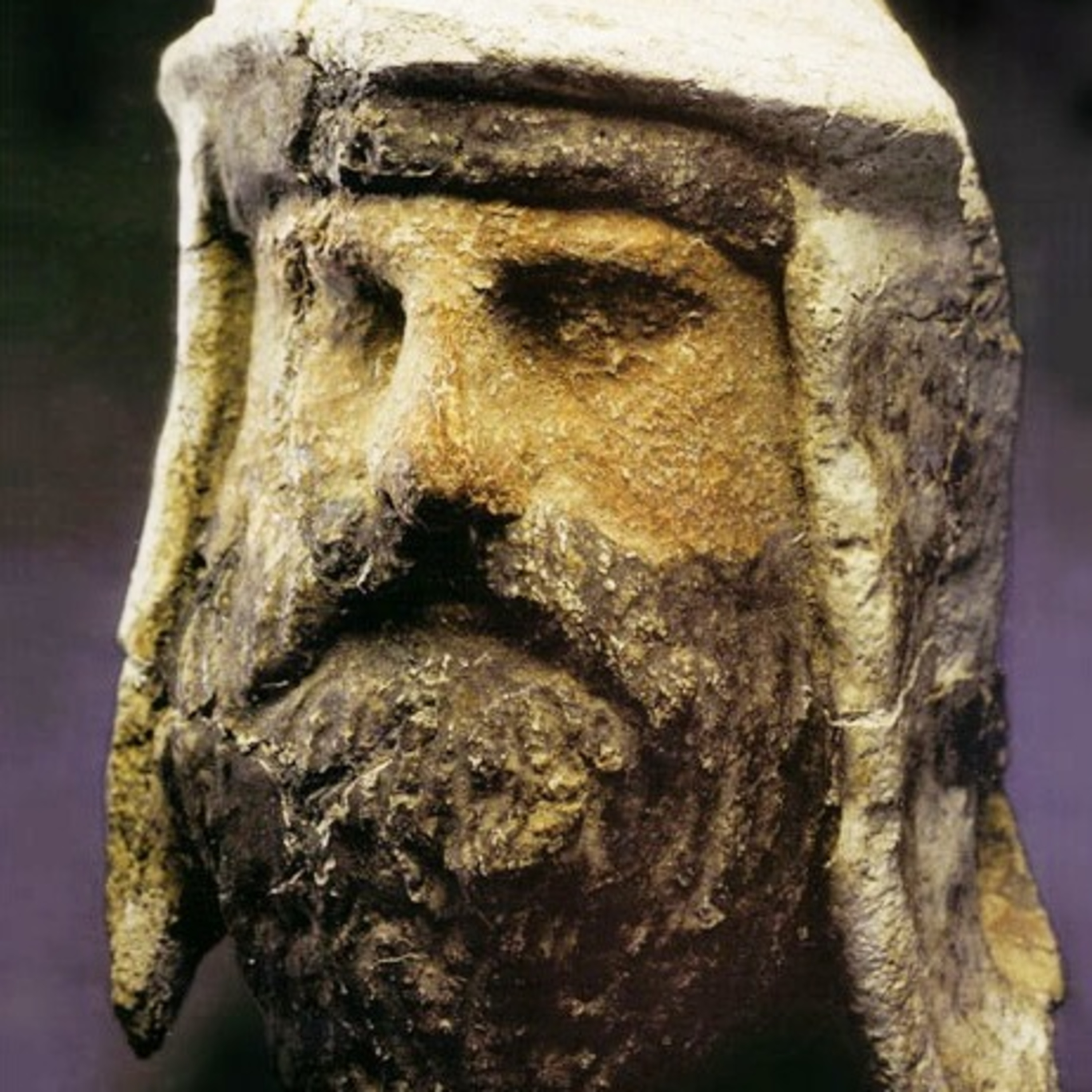 History List