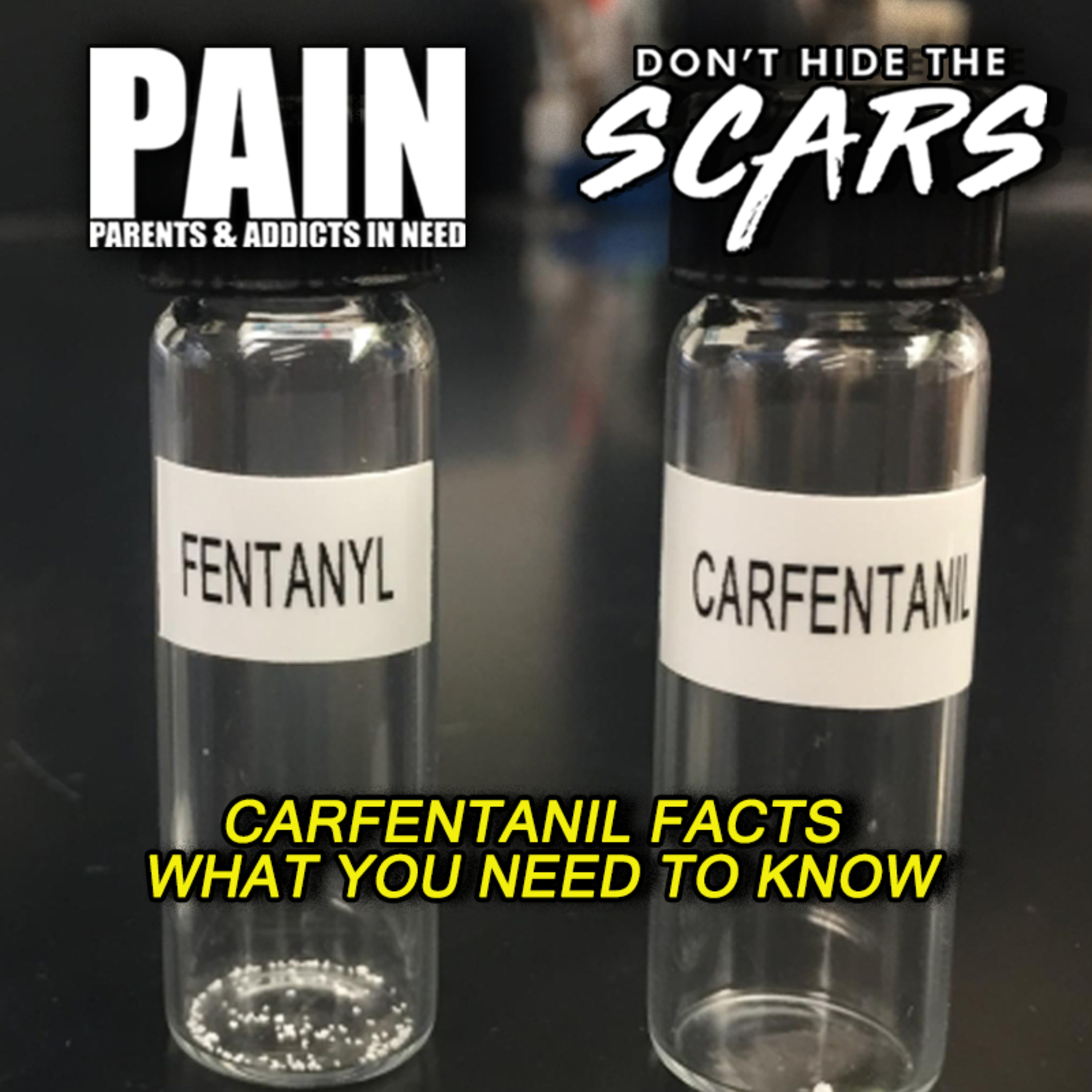 Don’t Hide The Scars. Presented By PAIN: Parents & Addicts In Need
