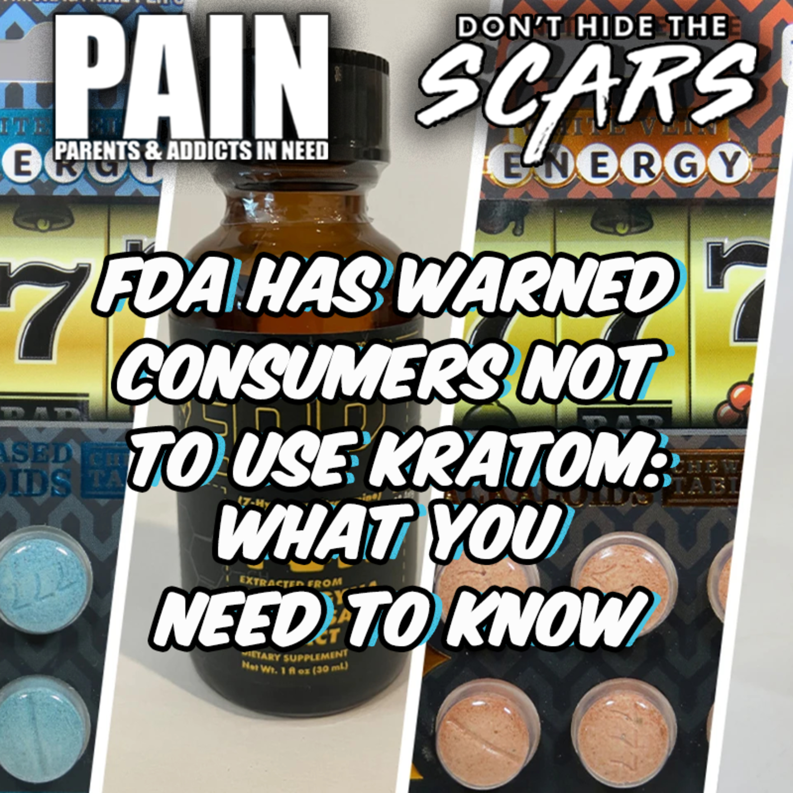 Don’t Hide The Scars. Presented By PAIN: Parents & Addicts In Need