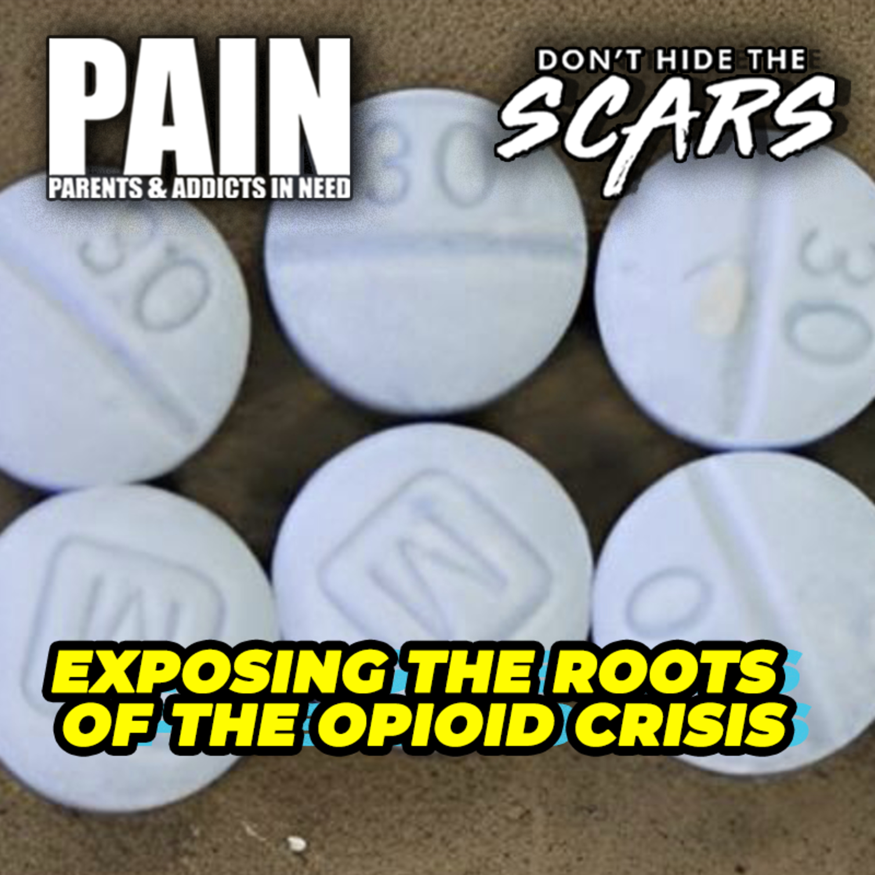 Don’t Hide The Scars. Presented By PAIN: Parents & Addicts In Need