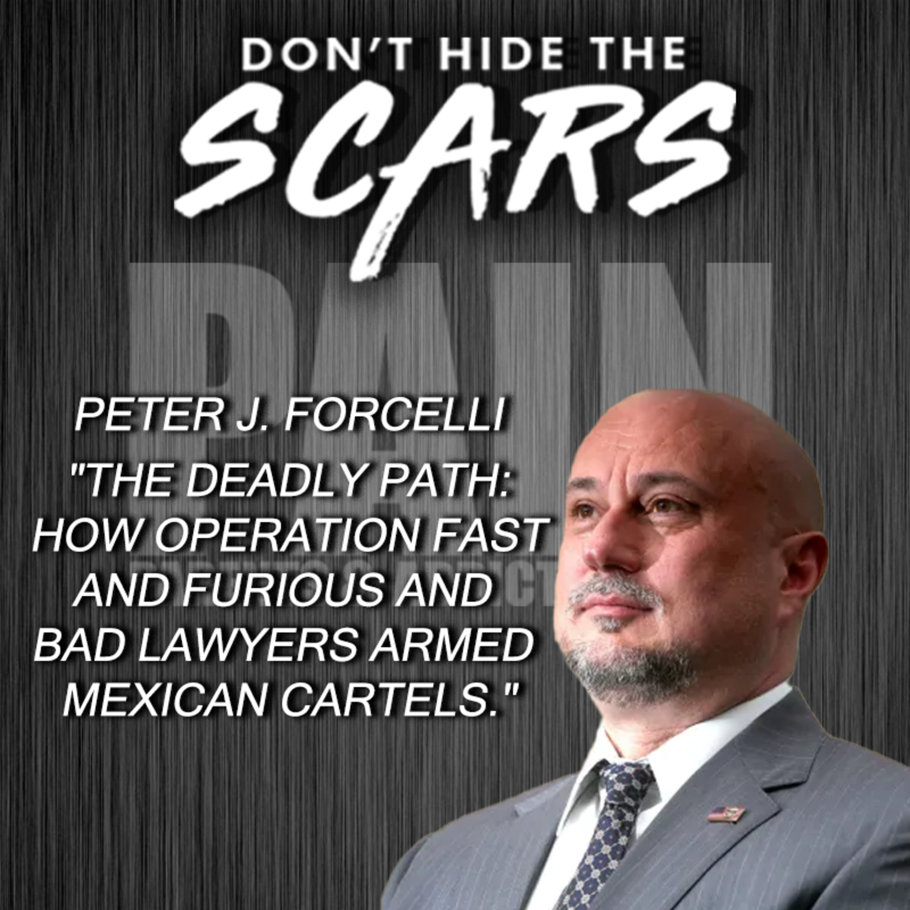 Don’t Hide The Scars. Presented By PAIN: Parents & Addicts In Need