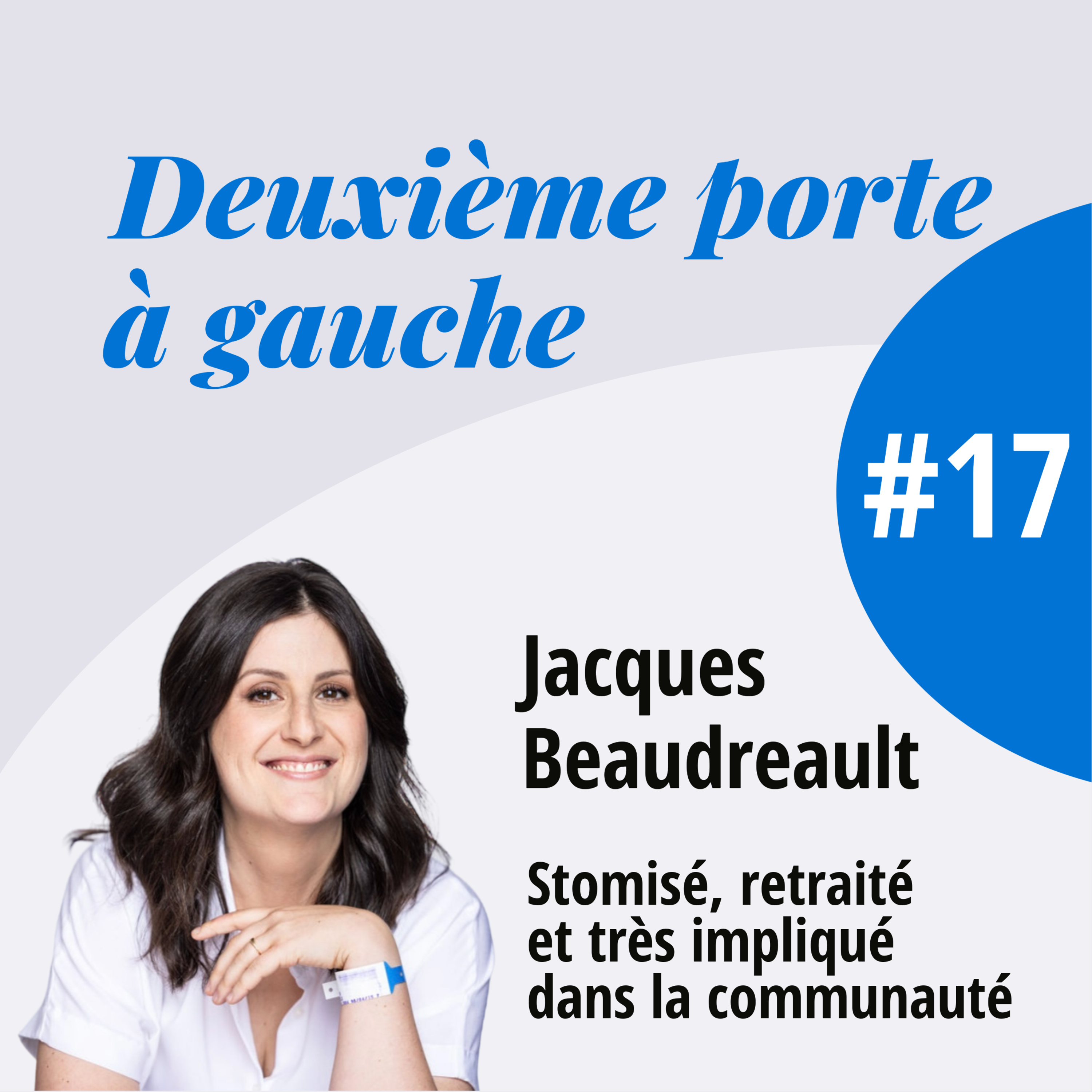 Jacques Beaudreault : la vie avec une stomie, de 1970 à aujourd'hui