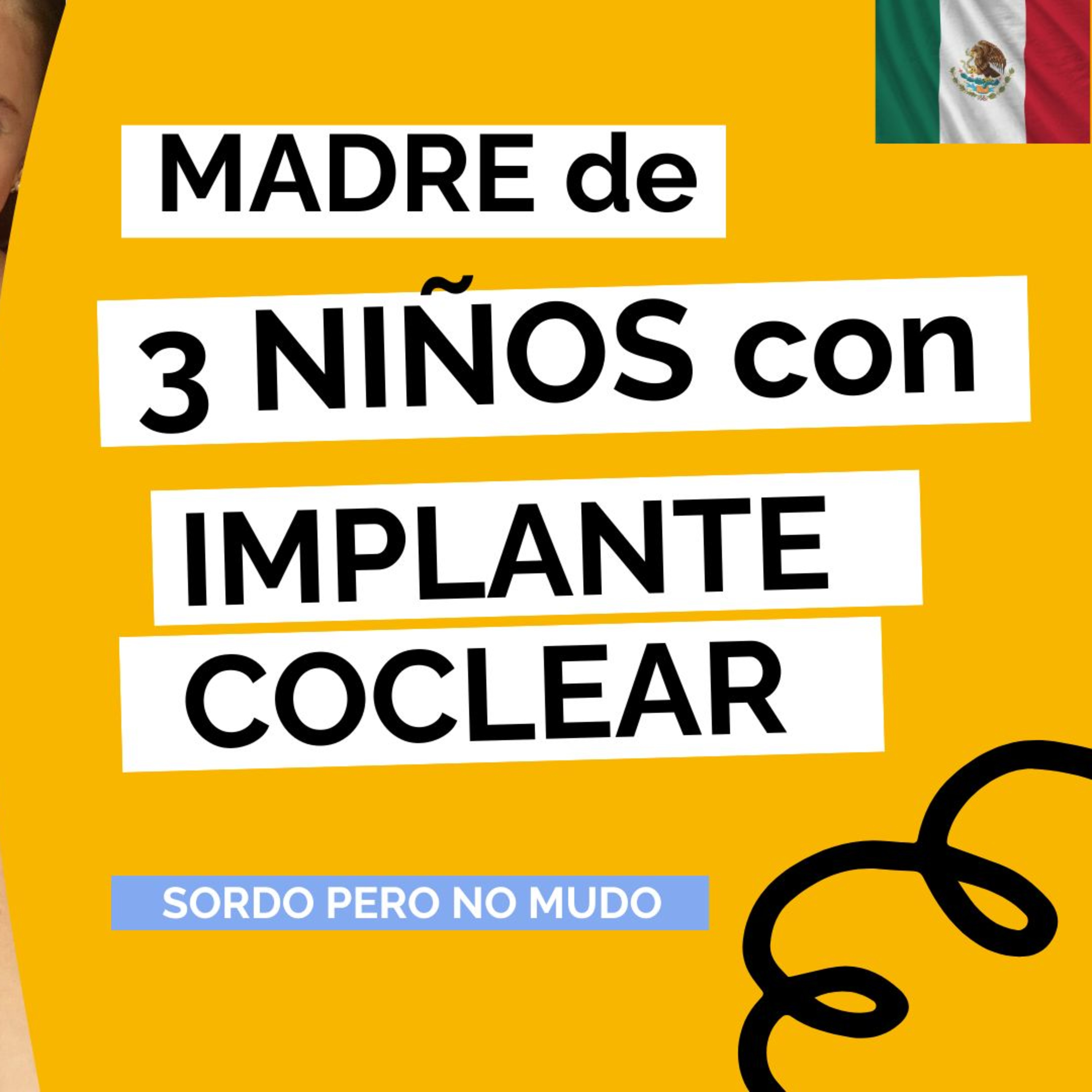 Sordo pero no mudo | Hablando desde mi hipoacusia