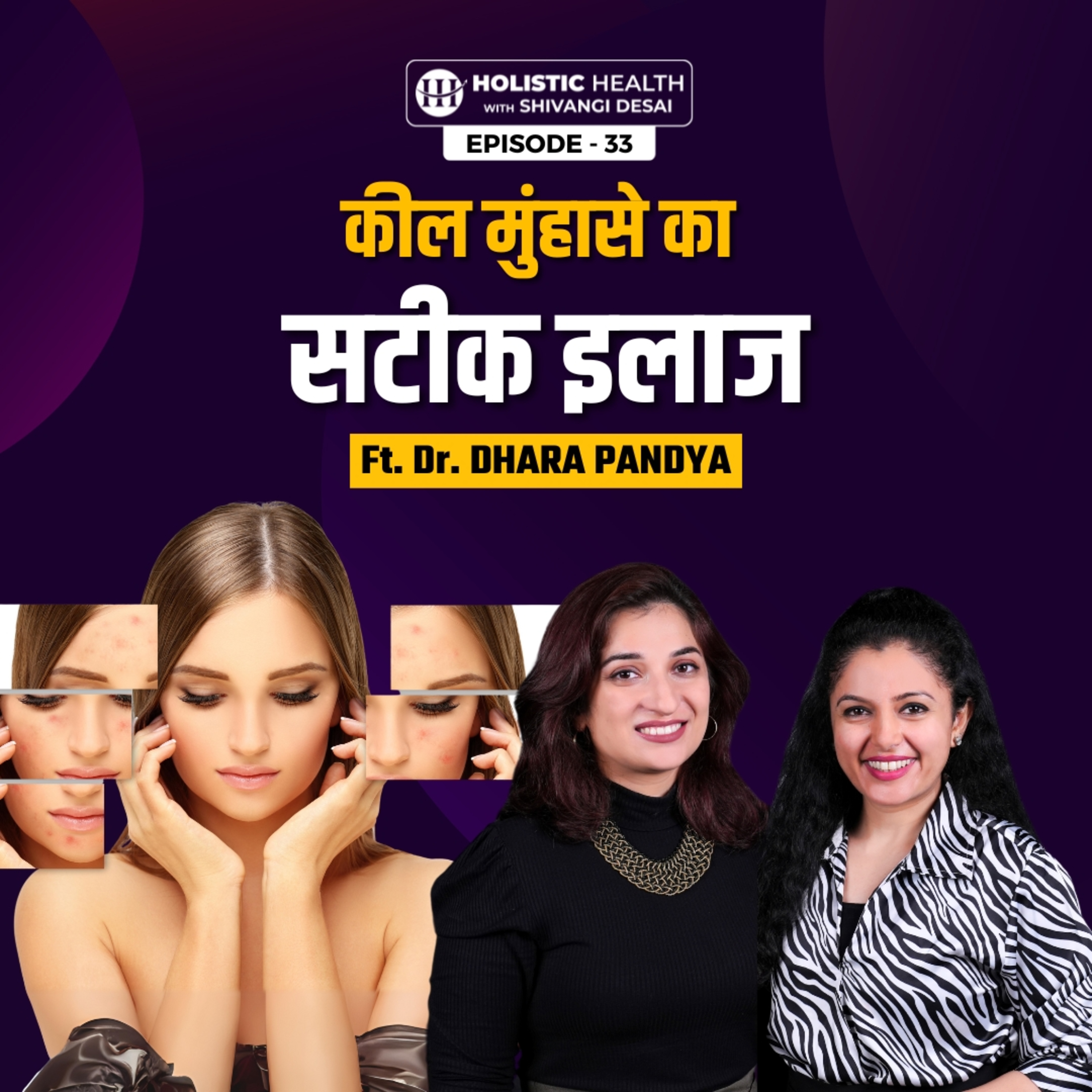 S1.E33 - What causes acne and how you can prevent it | Best Diet For Pimple (Acne) Free Skin | Shivangi Desai episode artwork