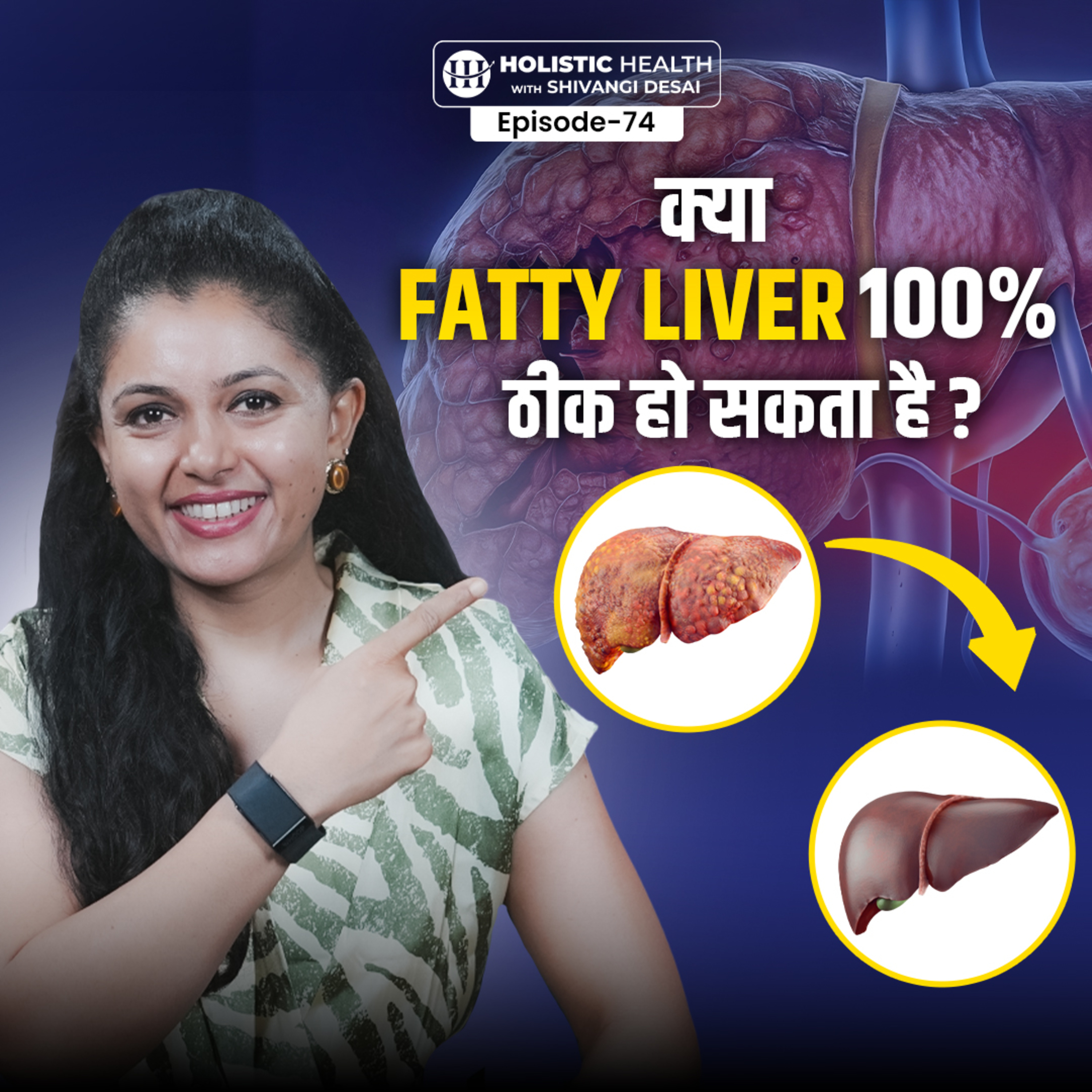 8 Science-Backed Lifestyle Changes to Reverse Fatty Liver Naturally | Shivangi Desai Podcast episode artwork