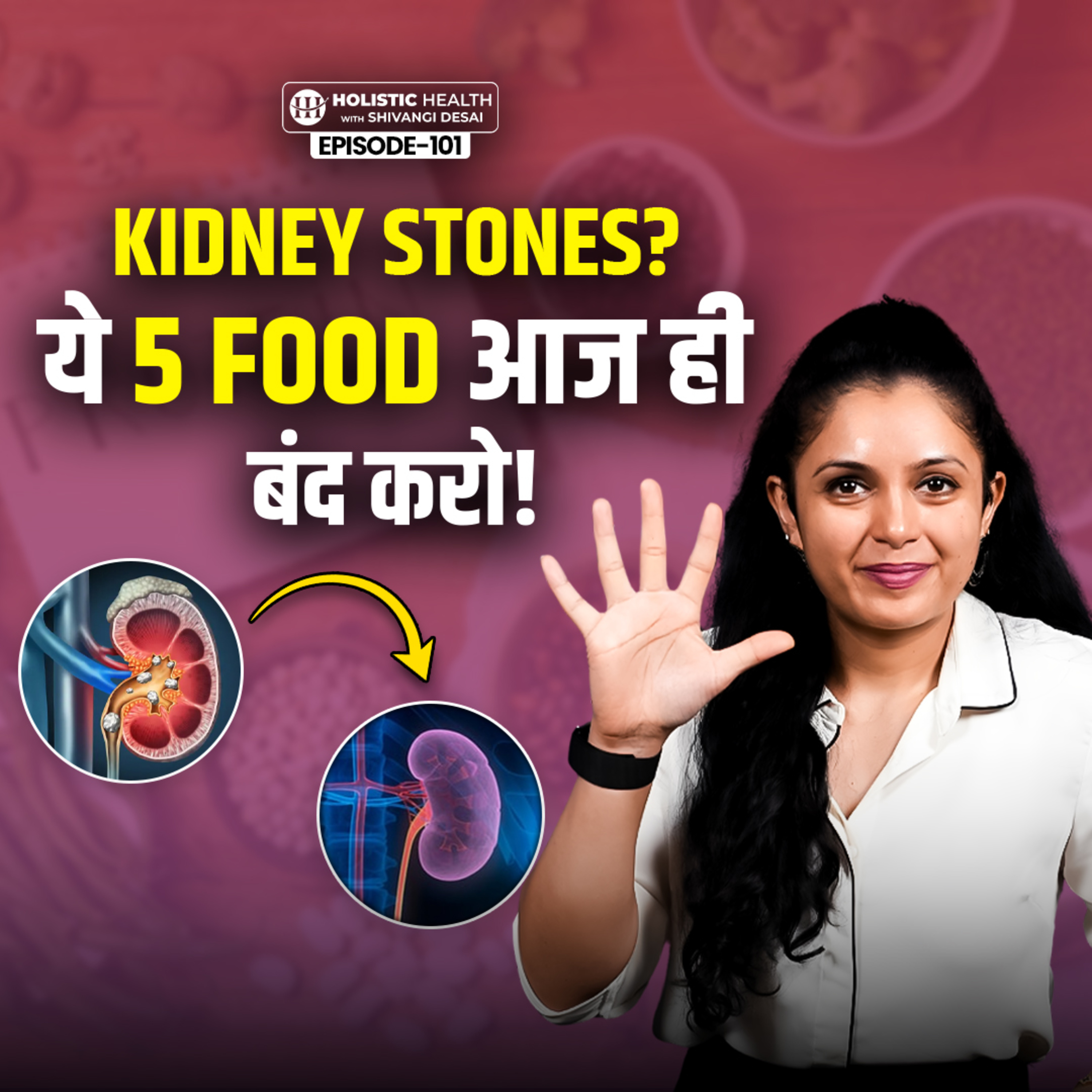 Natural Ways to Dissolve Kidney Stones | Best Foods for Kidney Health | Shivangi Desai Podcast