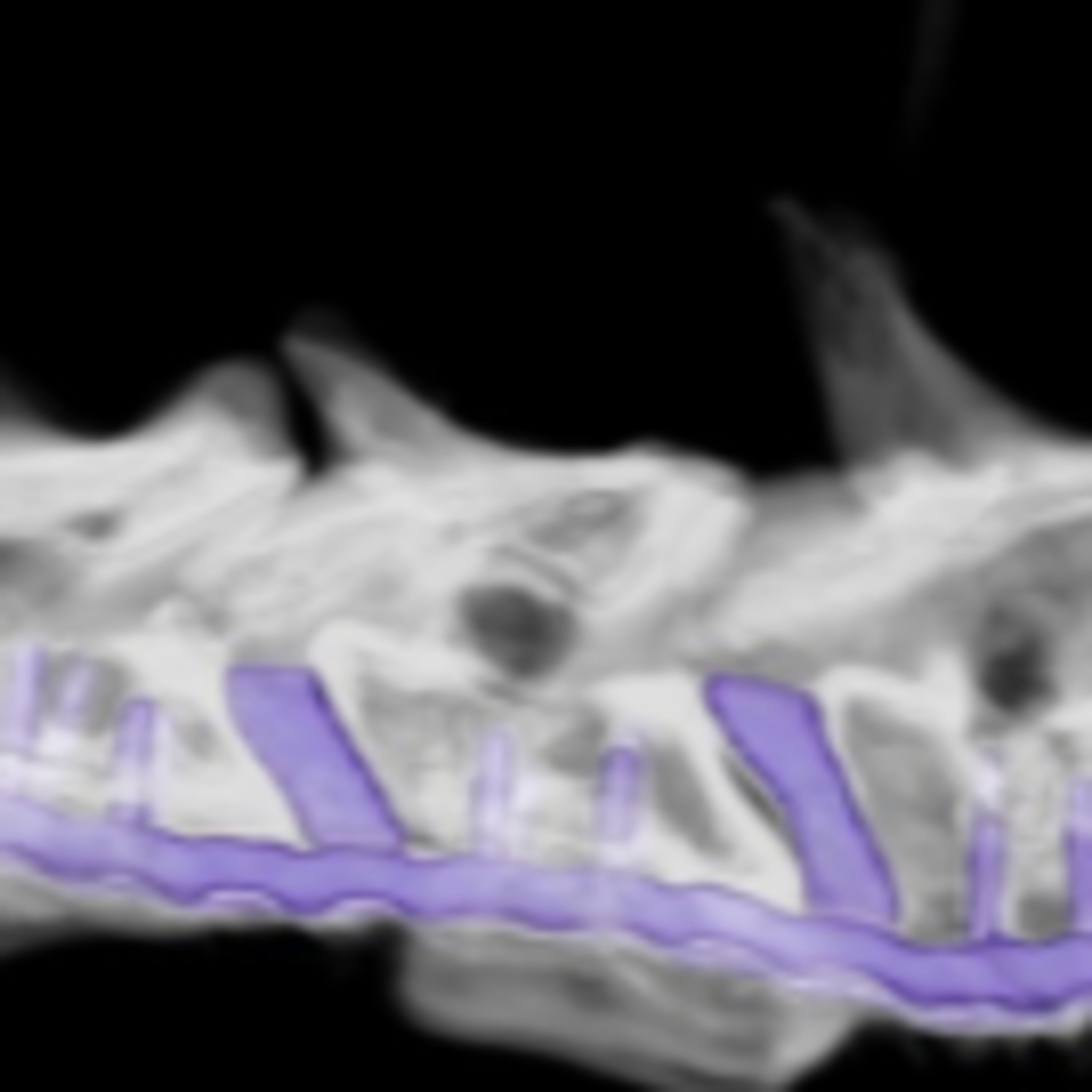 A new surgical interbody device for disc-associated cervical spondylomyelopathy in dogs episode artwork