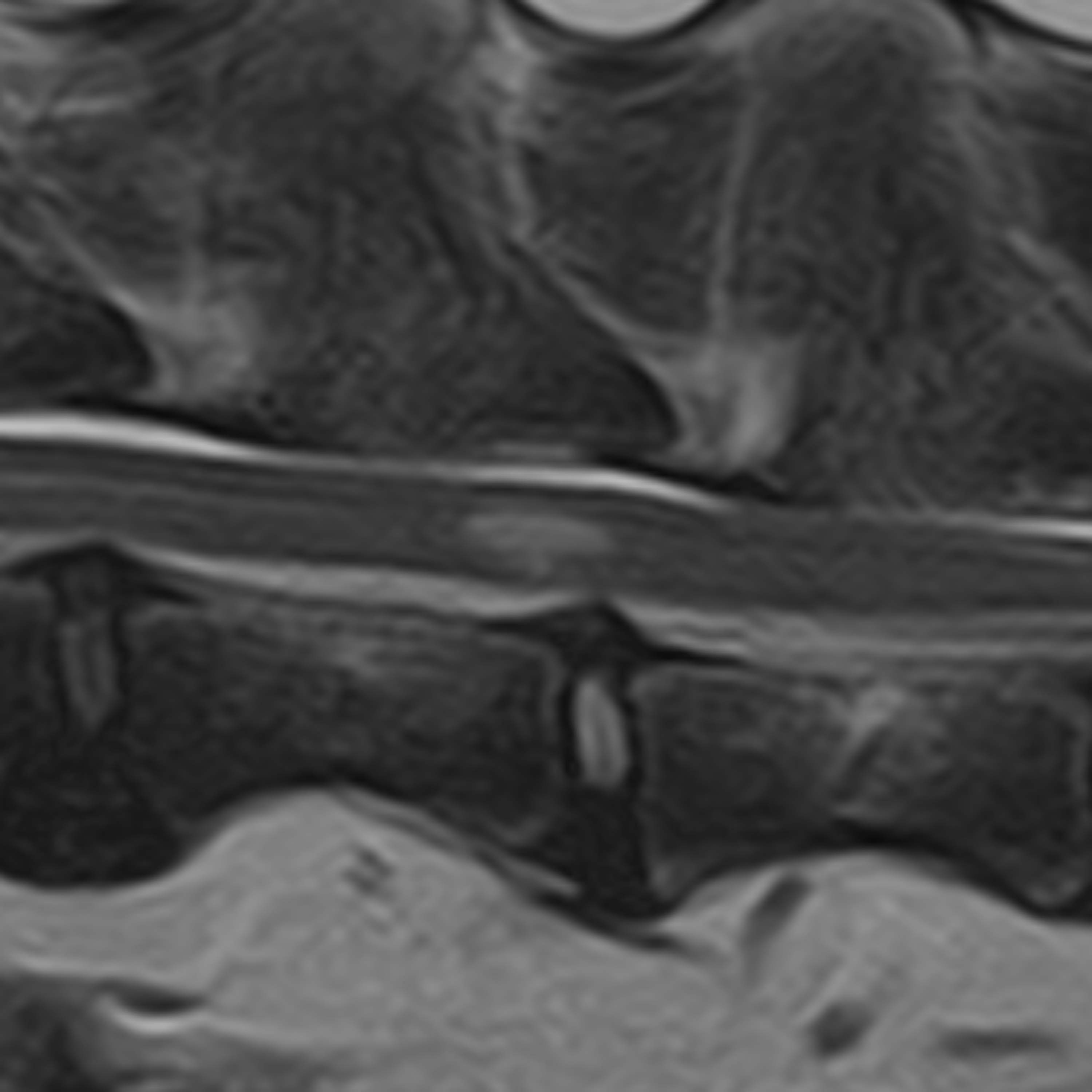 Comparing and contrasting FCEM and ANNPE in dogs using MRI episode artwork