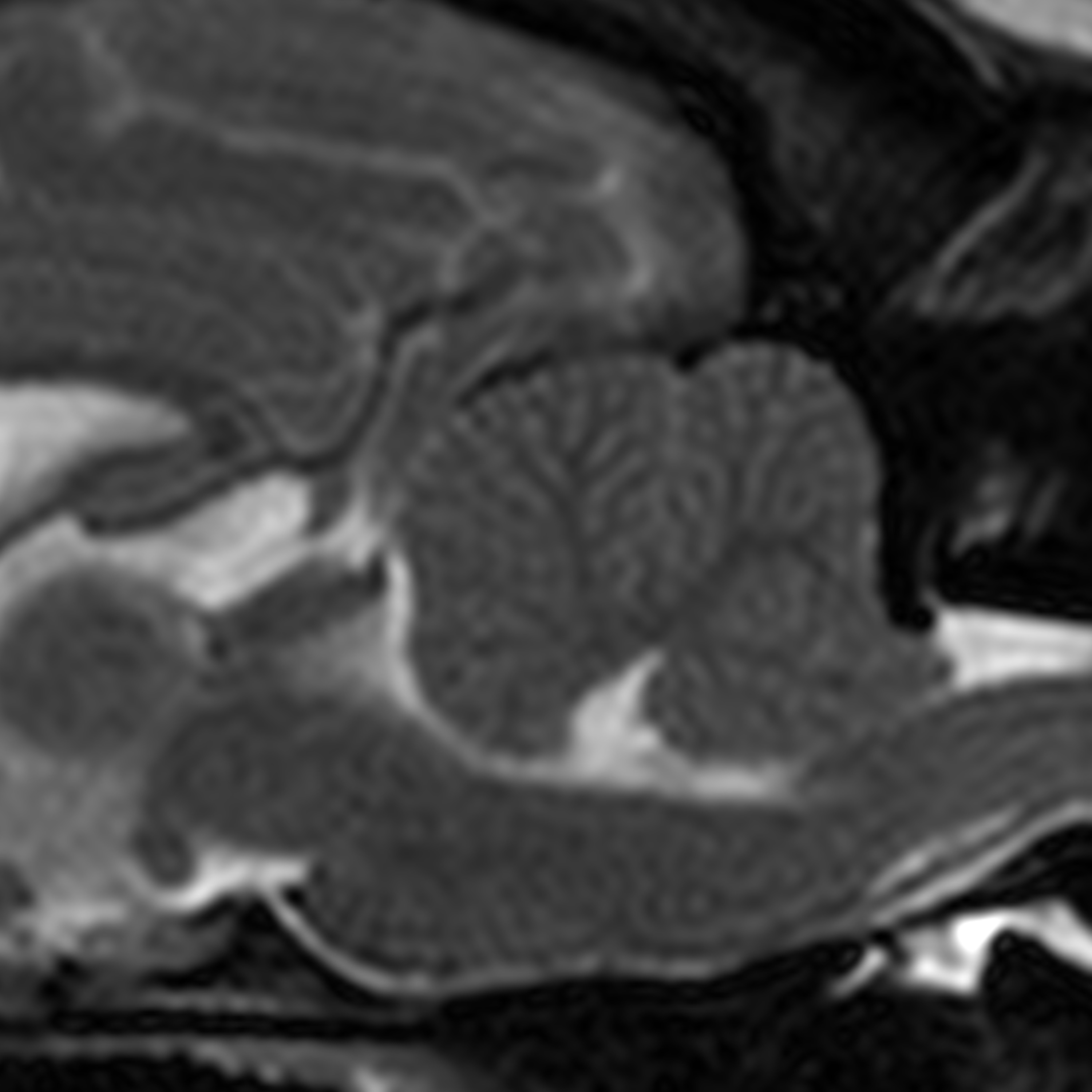 MRI-based Screening and Syringomyelia in Dutch and Danish CKCS episode artwork