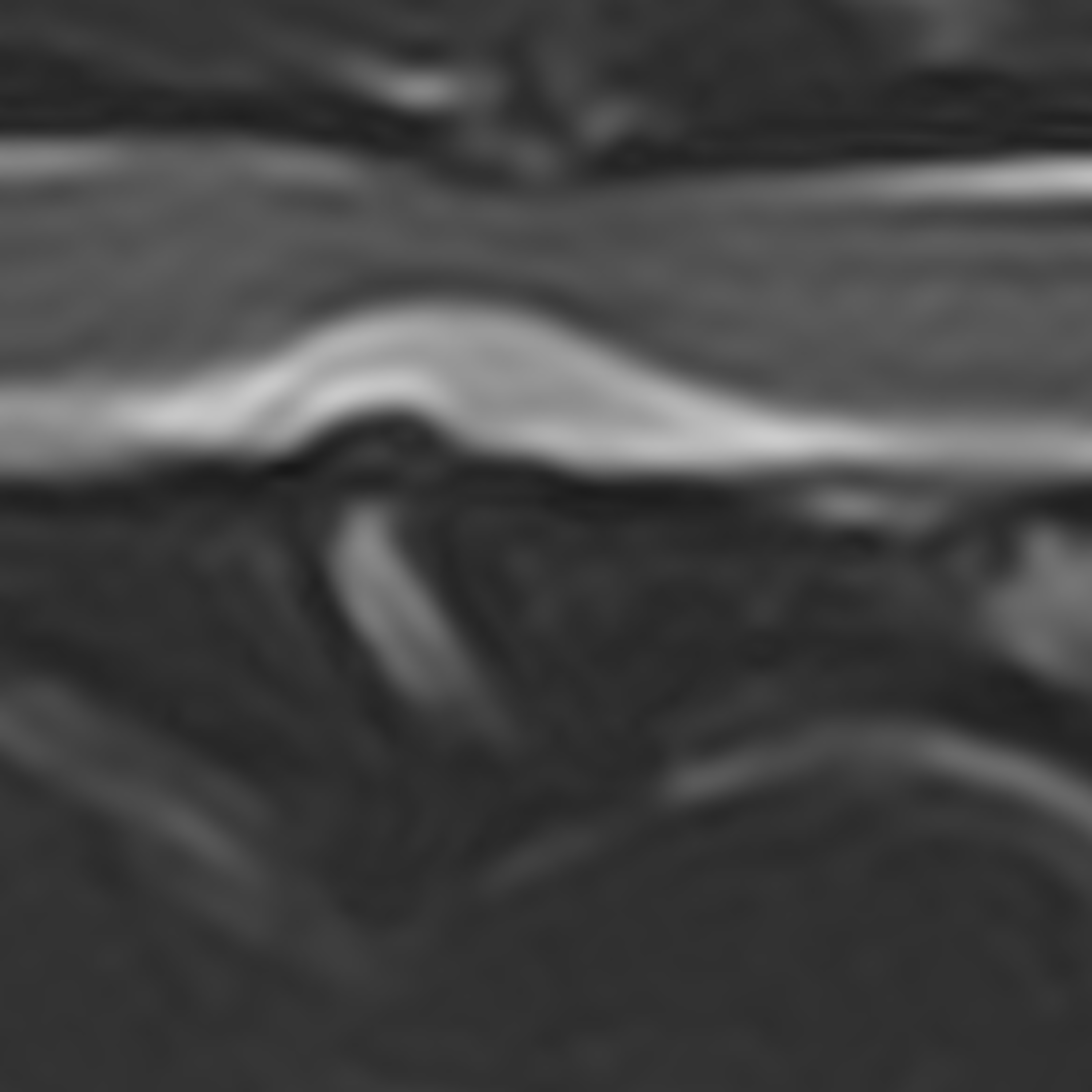 Thoracolumbar hydrated nucleus pulposus extrusion - clinical characteristics and MRI findings episode artwork