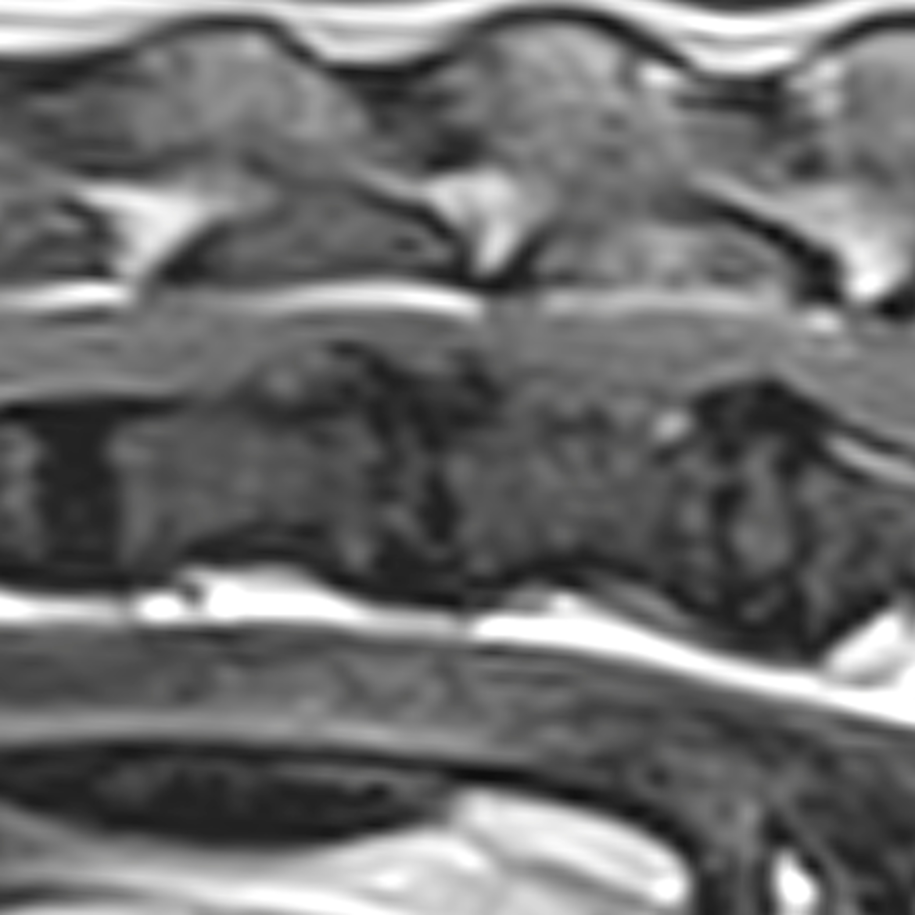 Prophylactic fenestration of intervertebral discs in chondrodystrophic dogs with follow up MRI episode artwork