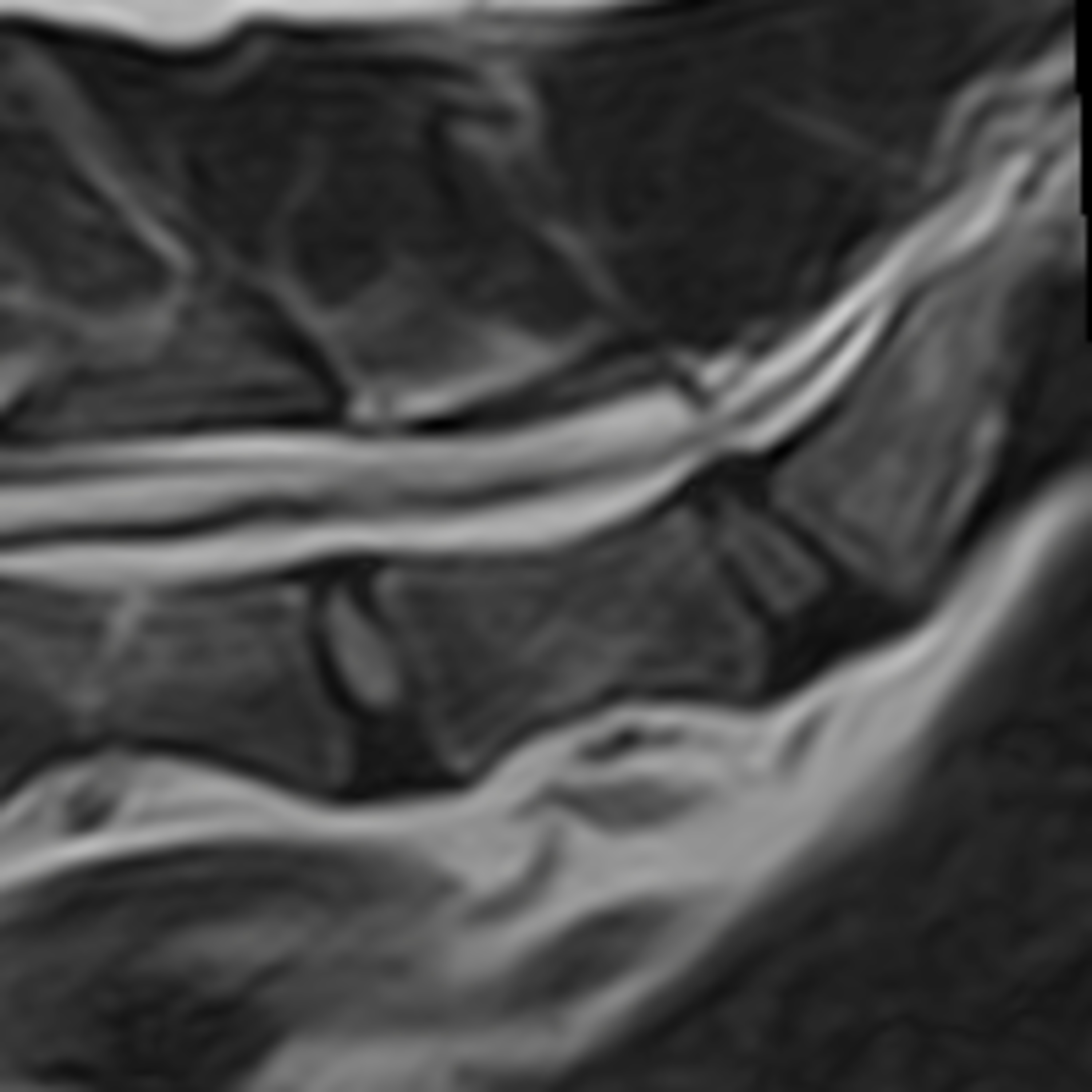 Occult Tethered Cord Syndrome in Dogs episode artwork