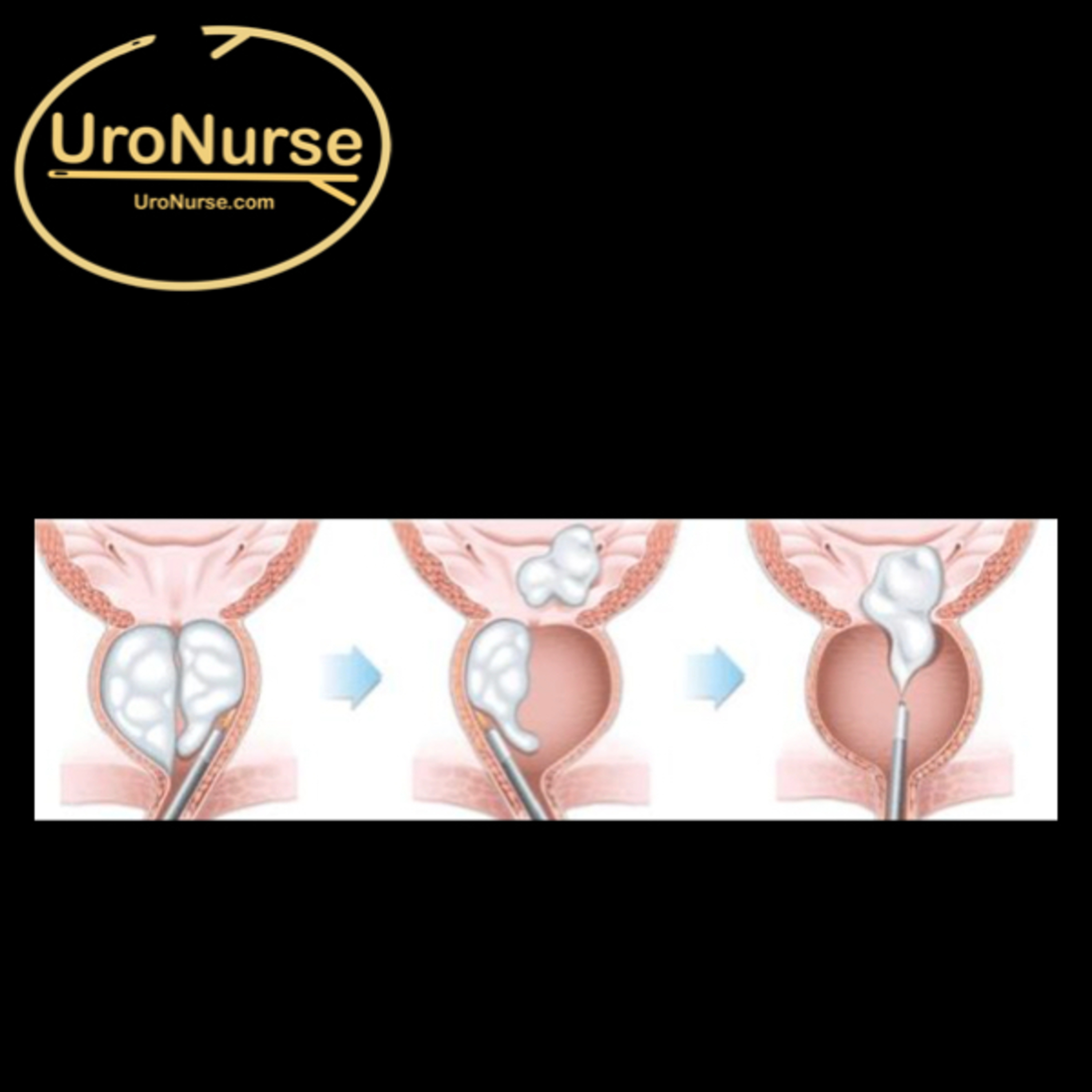 UroNurse