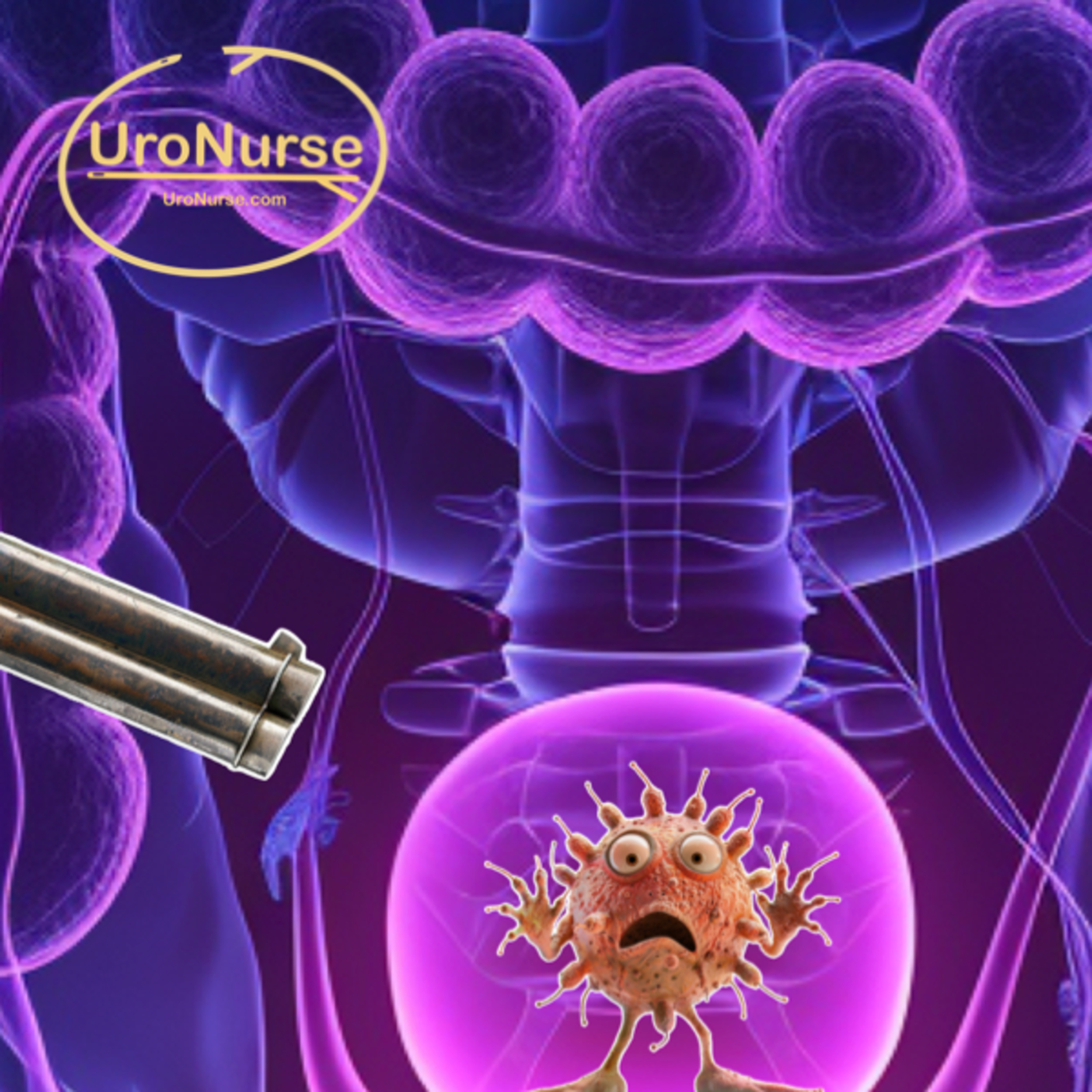 Episode 86: Dual Treatment For Bladder Cancer with Gemcitabine and Docetaxel Bladder Instillations