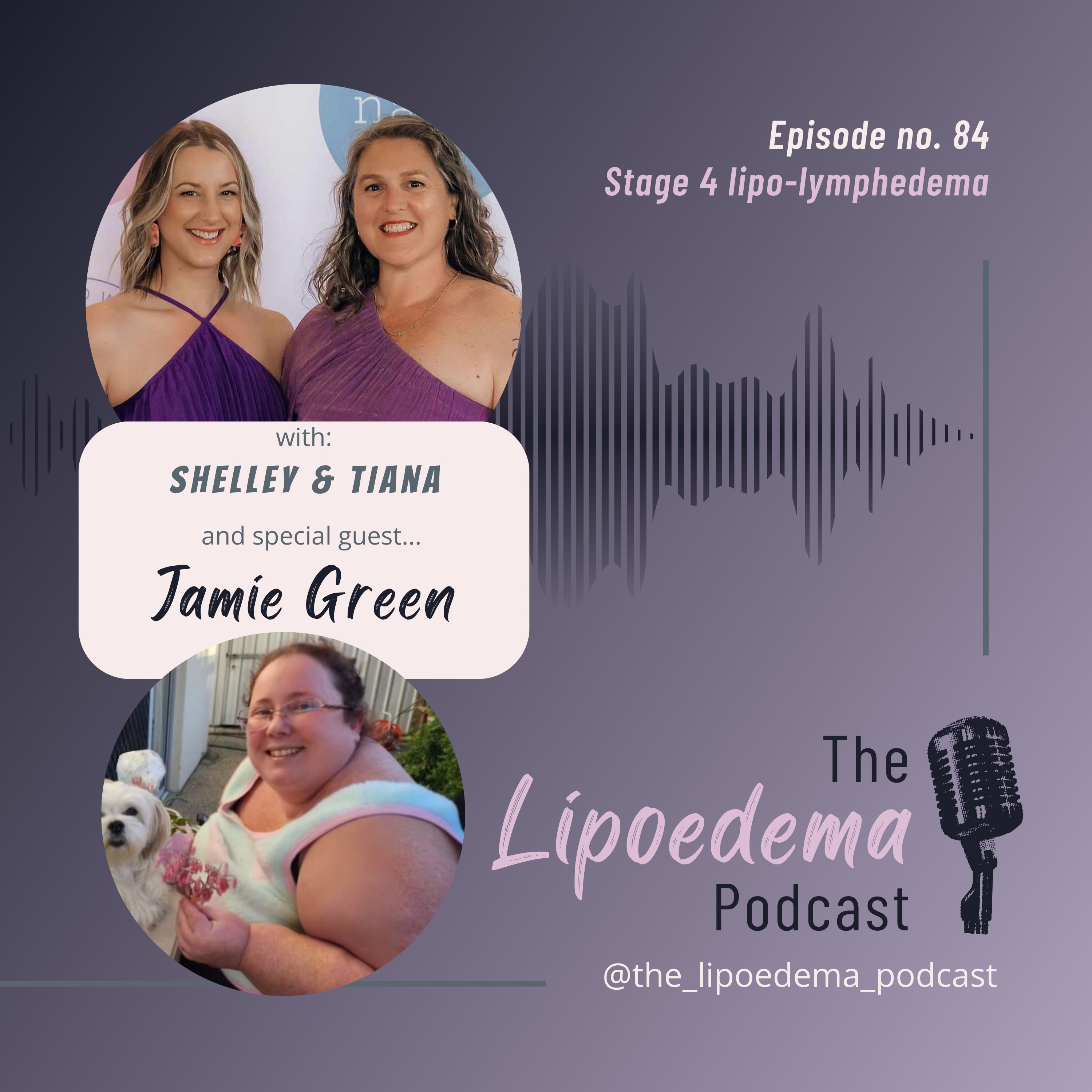 Ep. 84 ~ Stage 4 Lipoedema Warrior Jamie Green episode artwork