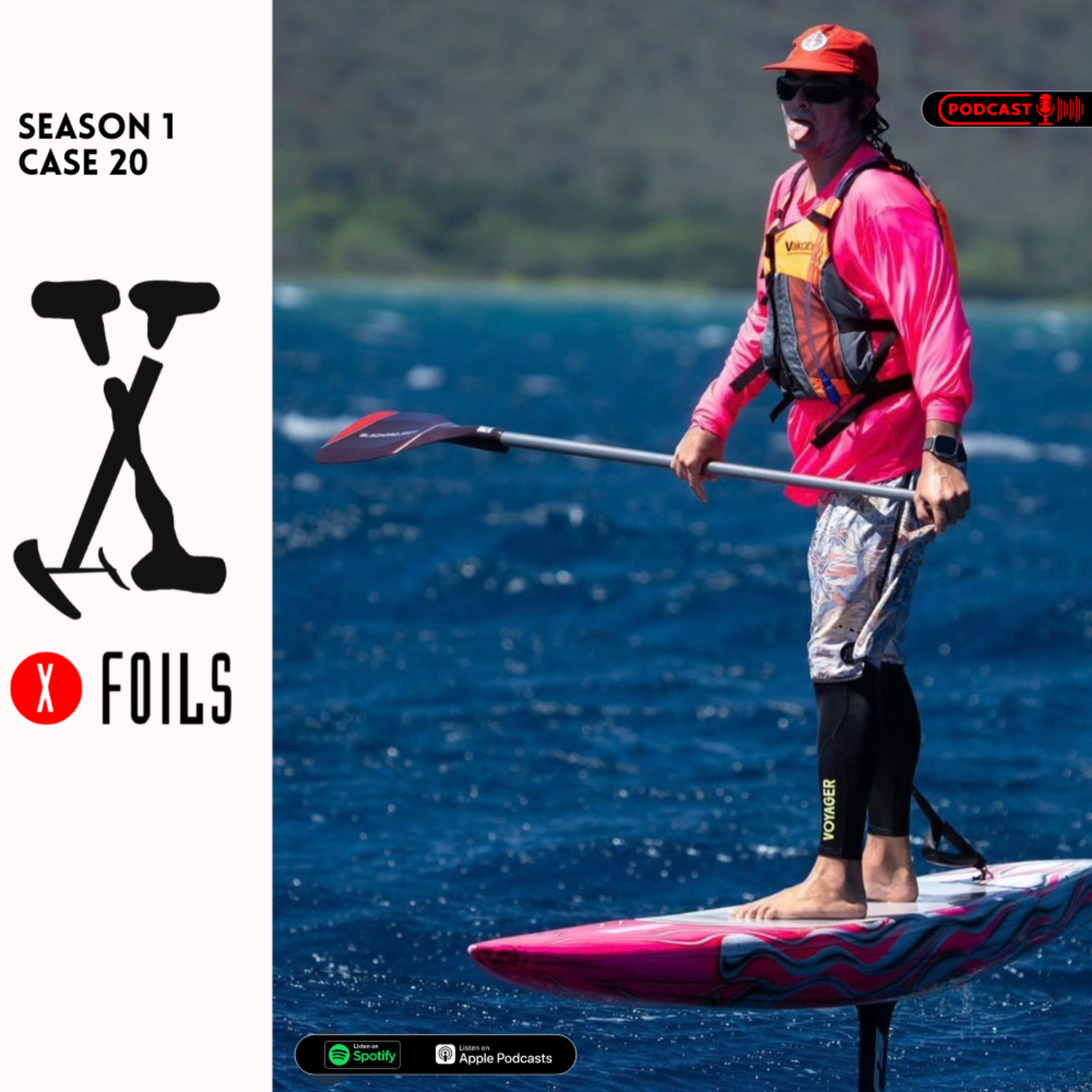 Case 20: Prescriptions to Precision, Franks Leap into Shaping Foilboards of the future