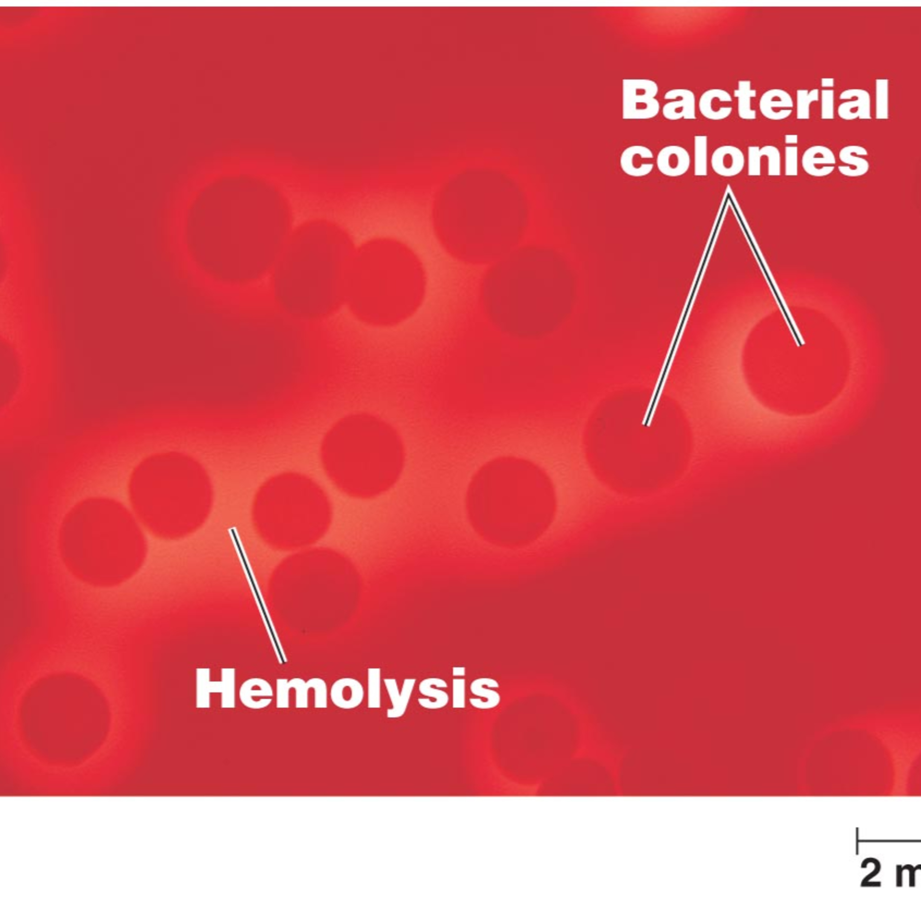Lab stuff: Staph vs Strep episode artwork