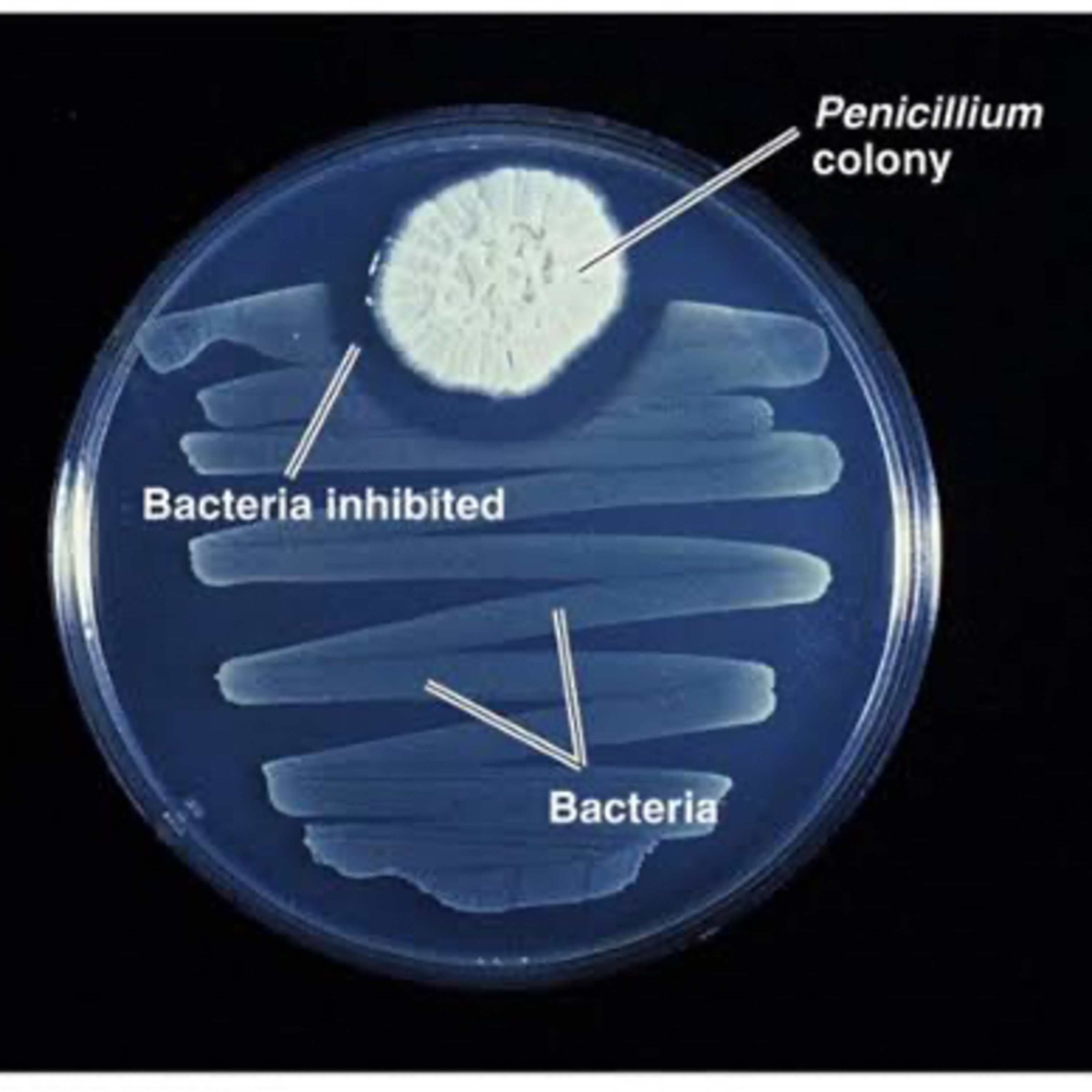 What is Antibiotic? How antibiotics were works ? What is bacteria? in Punjabi language