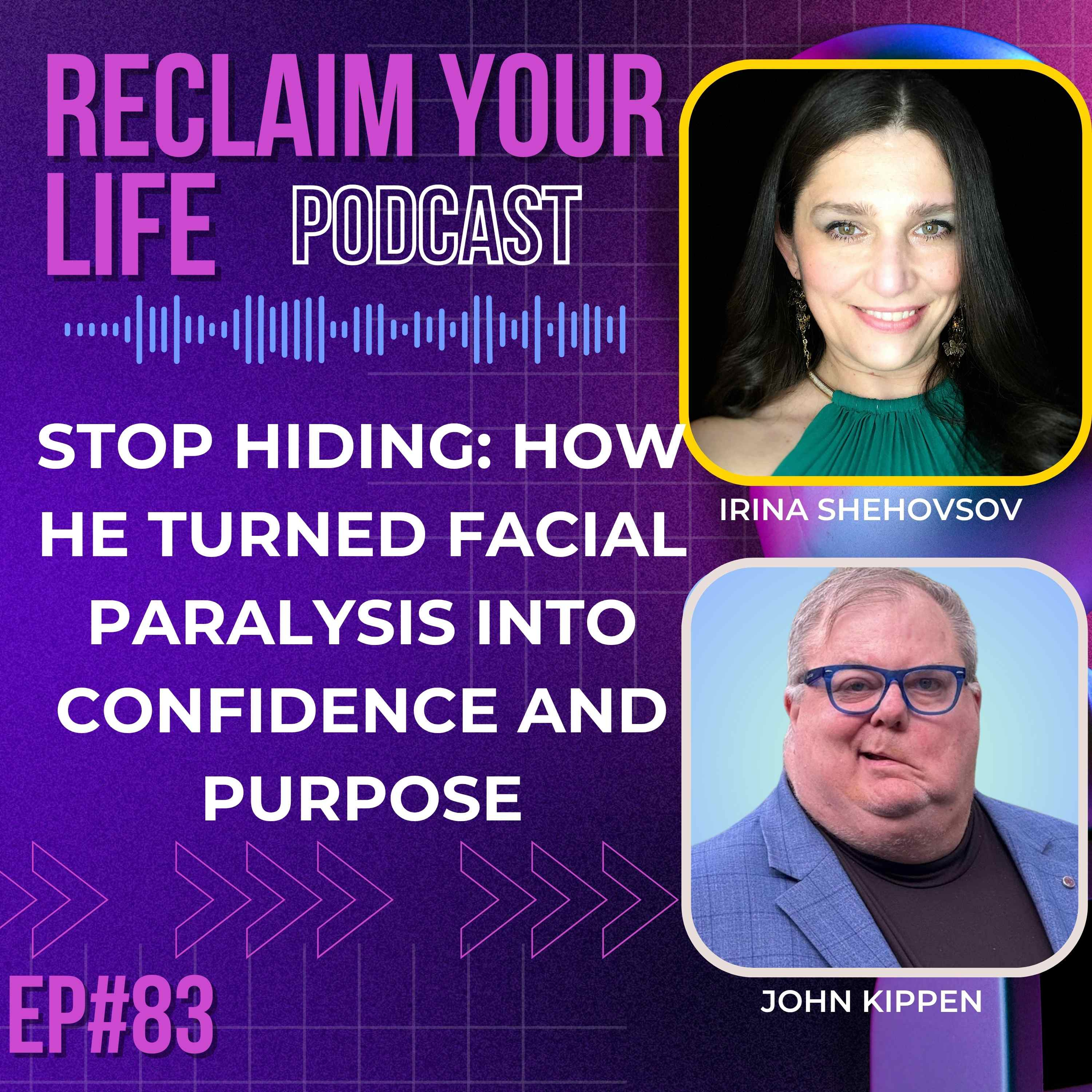 Stop Hiding: How He Turned Facial Paralysis Into Confidence and Purpose
