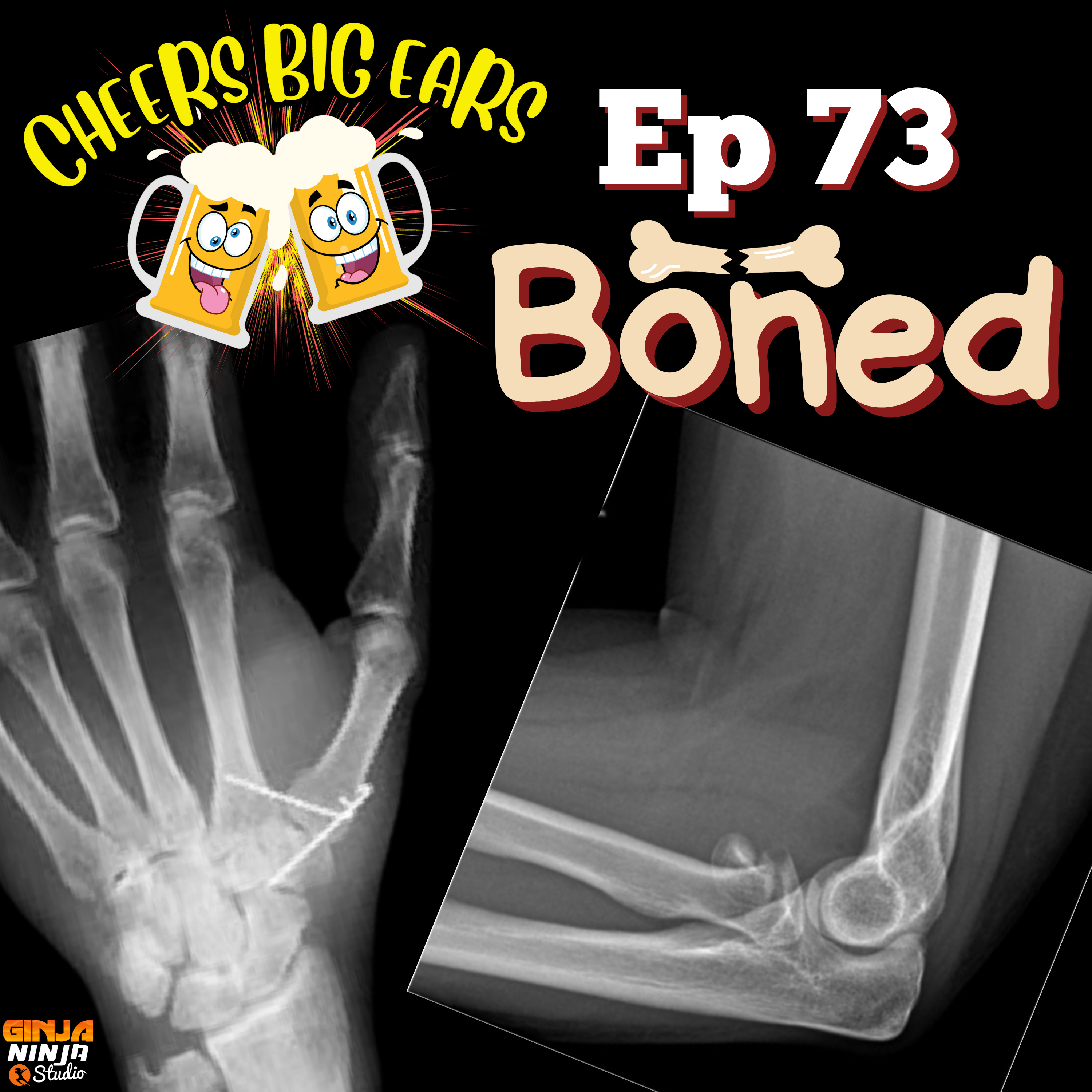 BONED | Cheers Big Ears Ep.73 episode artwork